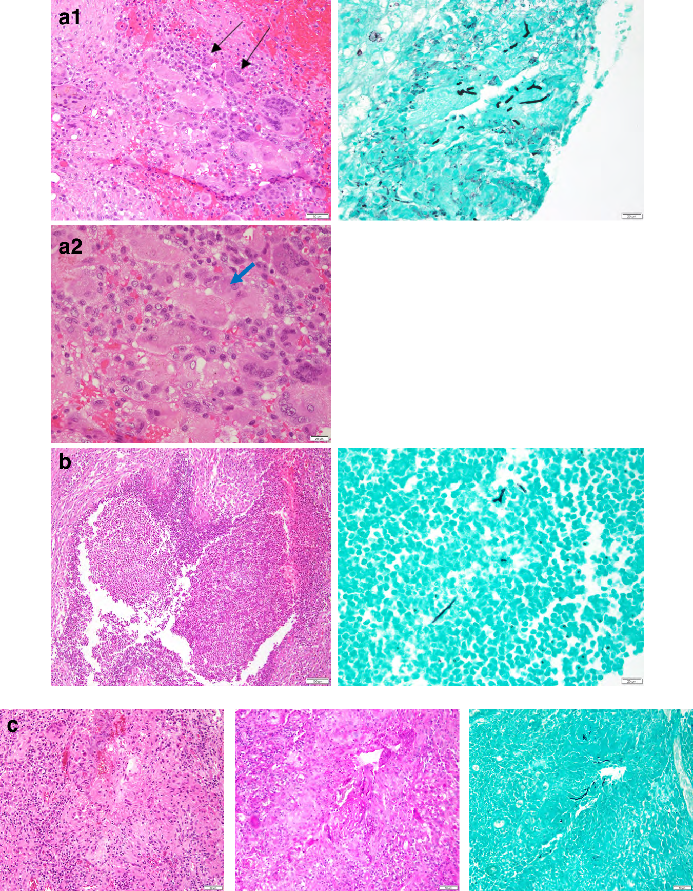 Fig. 2: Representative pathology imaging from 3 patients.