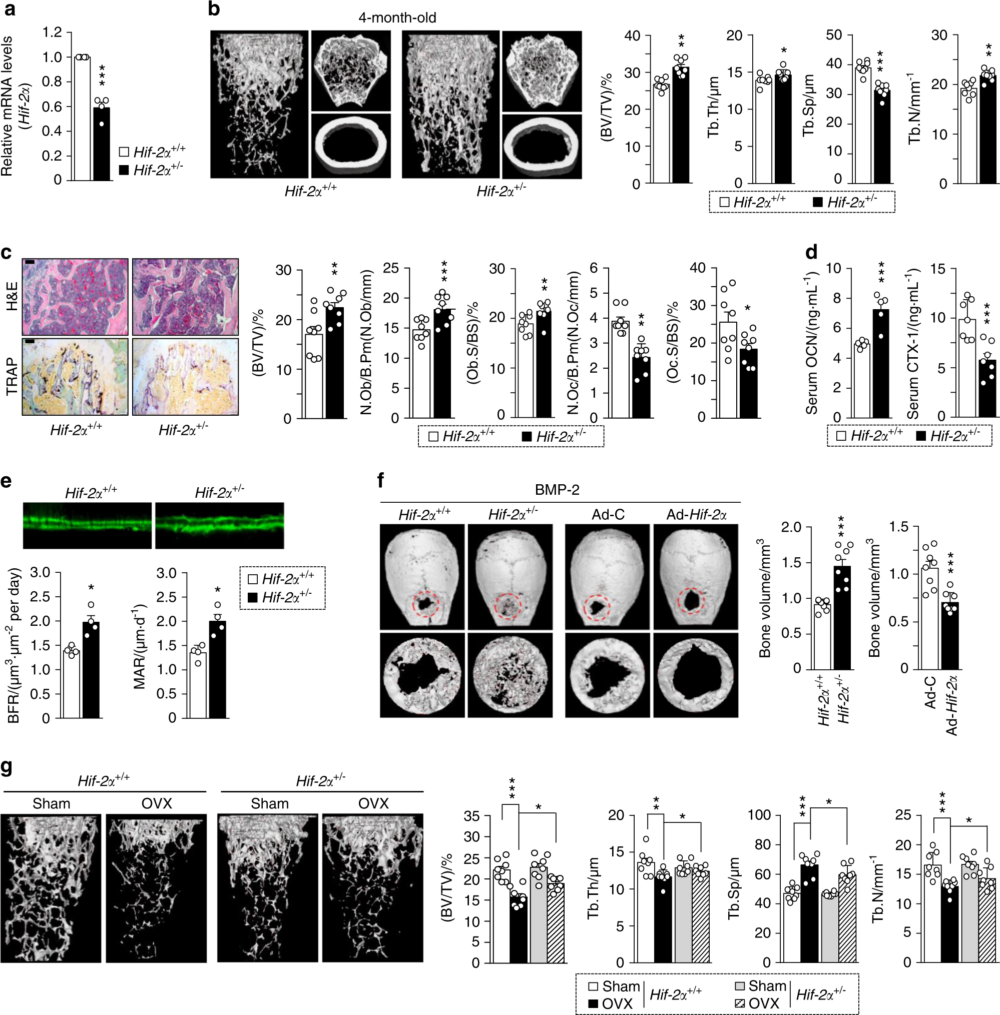 Controlling Hypoxia Inducible Factor 2a Is Critical For Maintaining Bone Homeostasis In Mice Bone Research