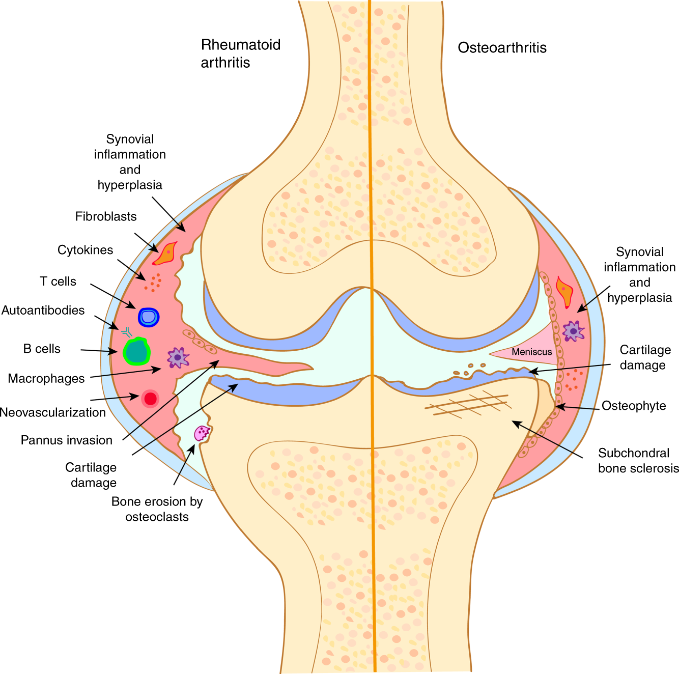 Arthritis and the role of endogenous glucocorticoids