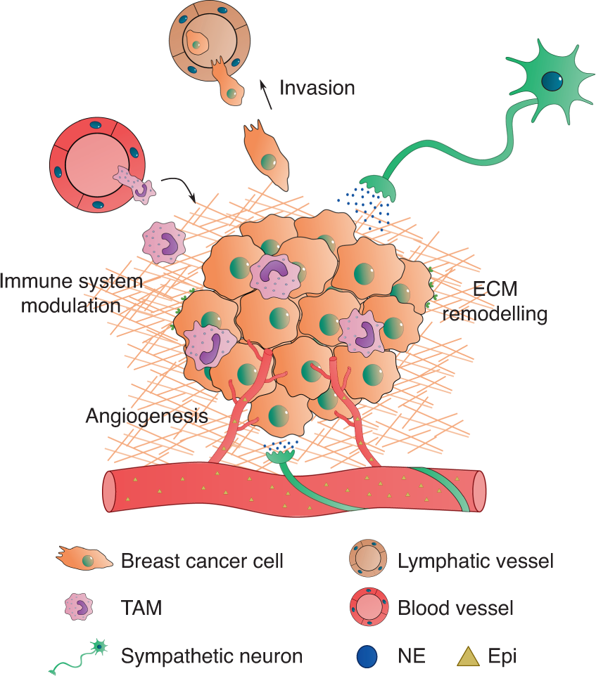 Sympathetic activity in breast cancer and metastasis: partners in crime |  Bone Research