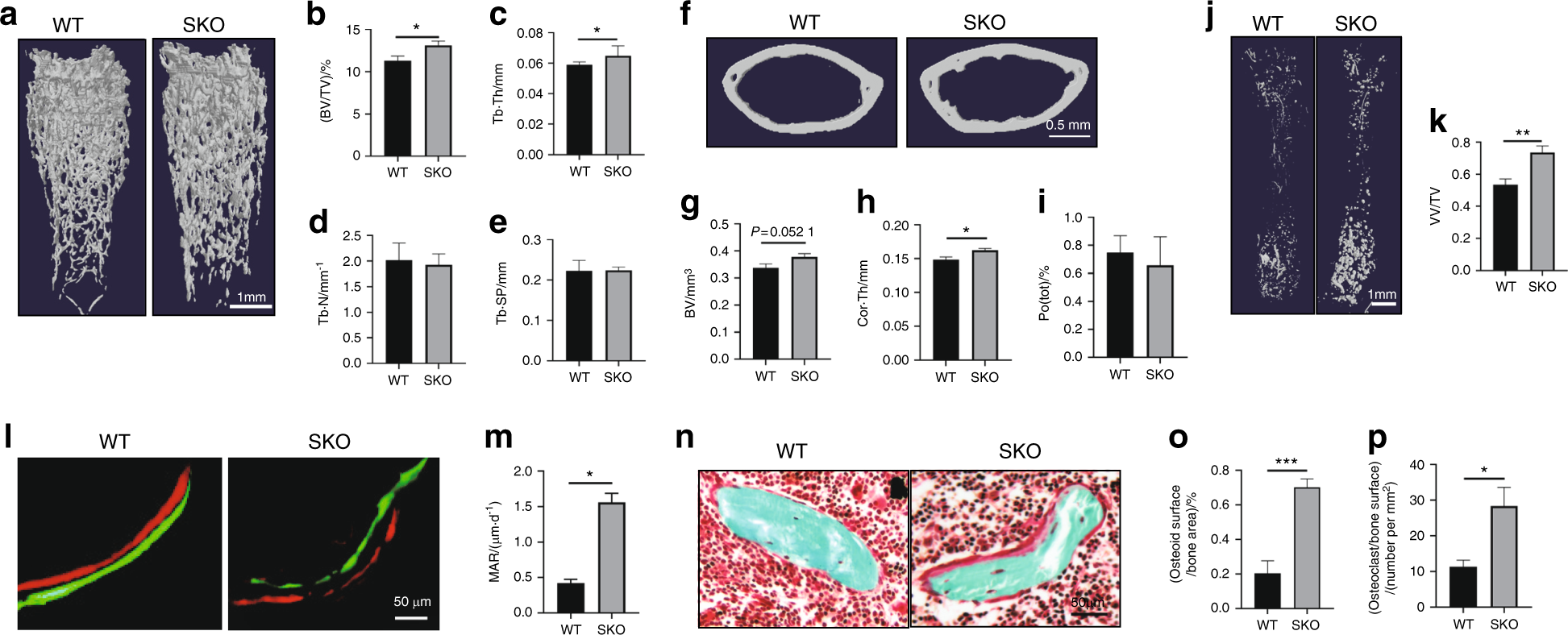 An antibody against Siglec-15 promotes bone formation and fracture healing  by increasing TRAP+ mononuclear cells and PDGF-BB secretion | Bone Research