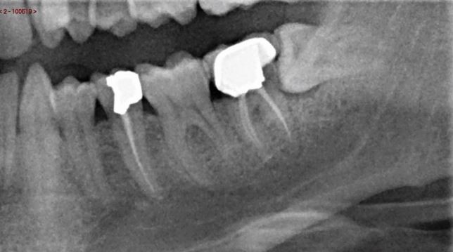 Deceptive radiographs | British Dental Journal