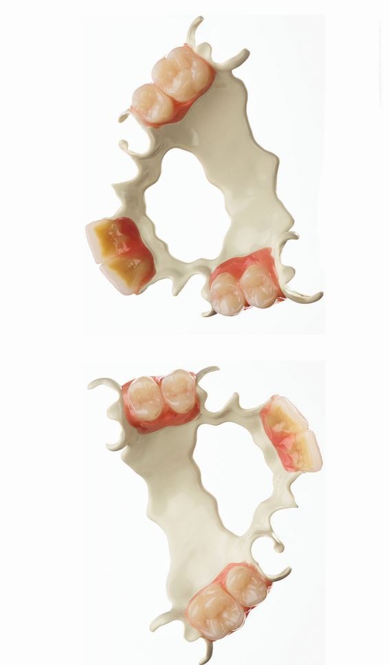 dsiper rpd Advanced, metal-free RPDs The Temple of Elementary andrew huberman on bpc thymosin beta fragment Quantity:Pack of 10