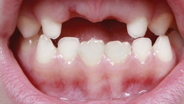 Build a positive dental experience for kids | British Dental Journal