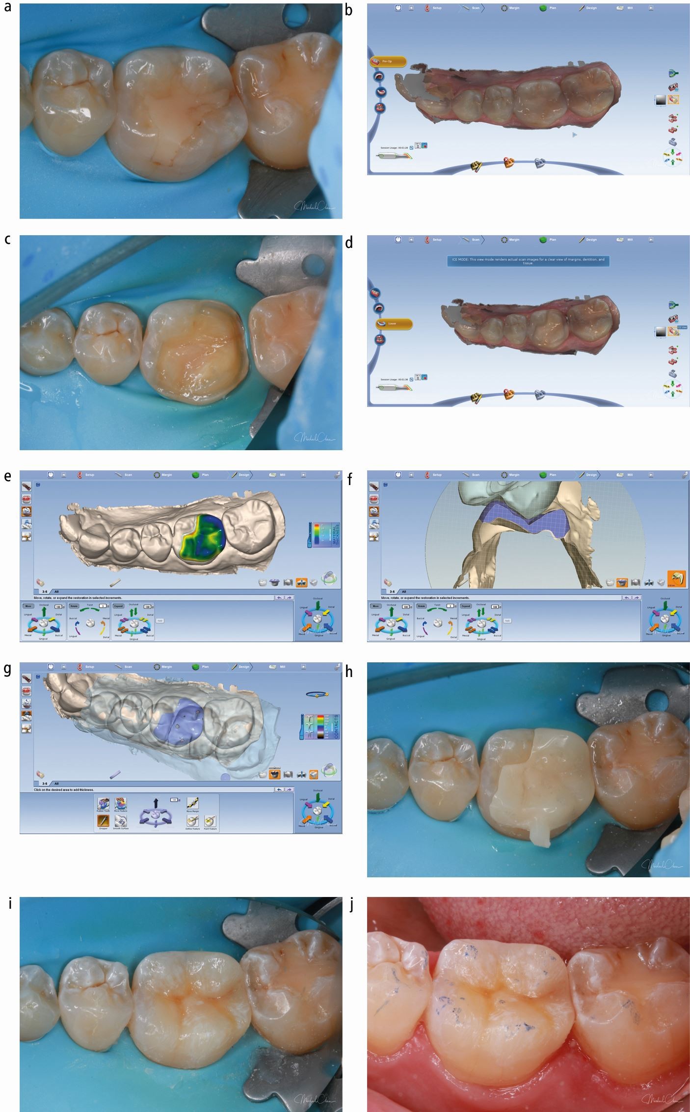 shillingburg fundamentals of fixed prosthodontics pdf shillingburg fundamentals of fixed prosthodontics pdf