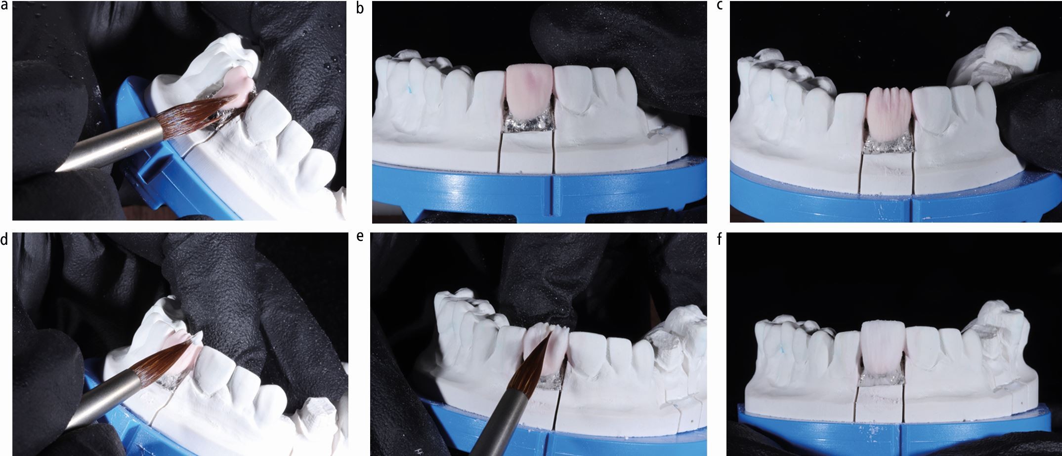 Do you know your ceramics? Part 2: feldspathic ceramics | British Dental  Journal