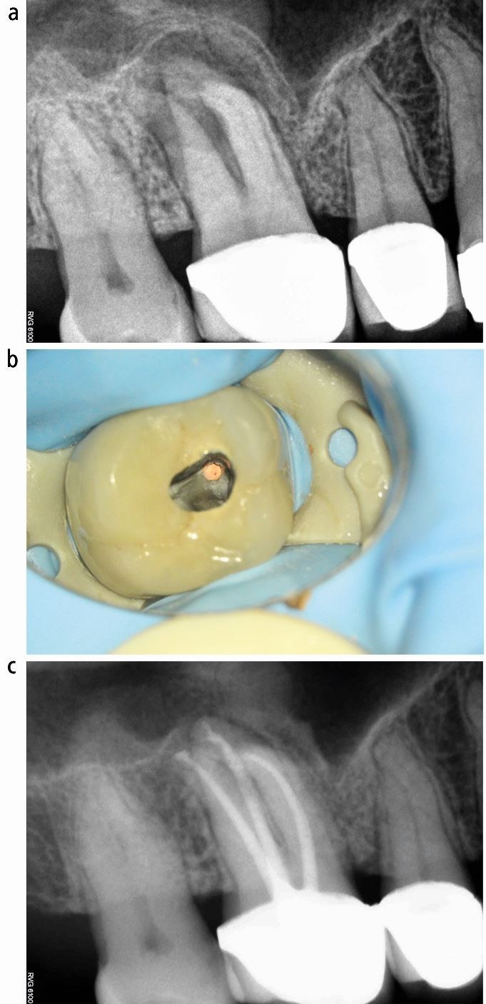 Considerations for restorative dentistry secondary care referrals - part 2:  predictability of treatment | British Dental Journal