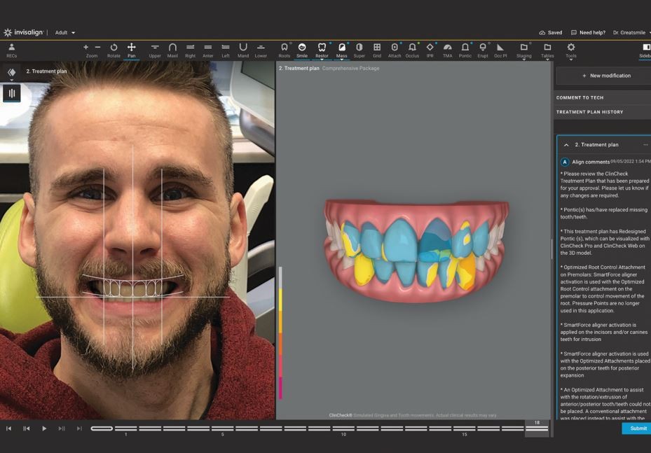 Align Technology launches Invisalign Smile Architect at European