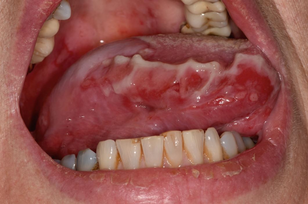Fig. 1