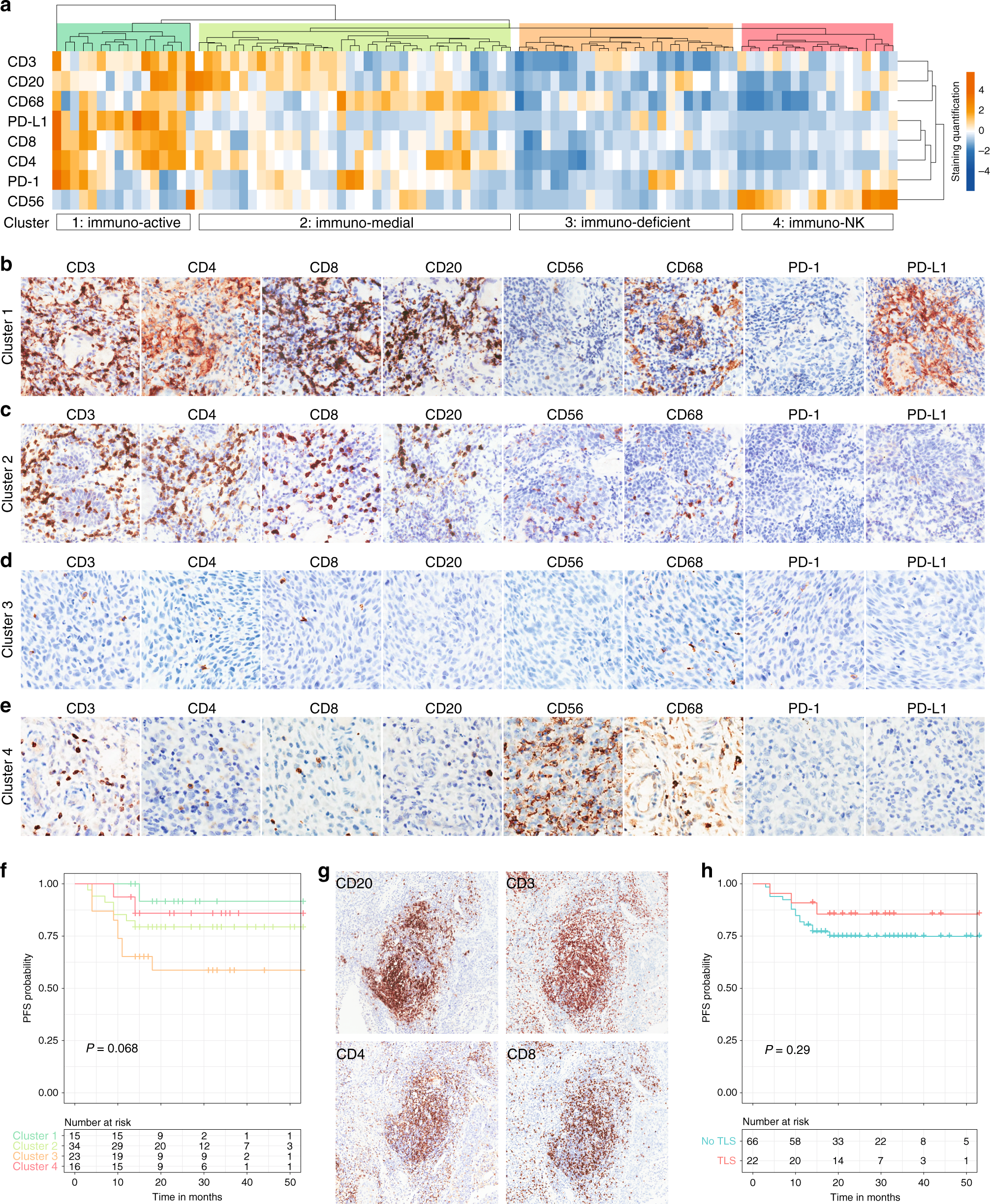 Fig. 2: Association of immune infiltrates with patient prognosis.