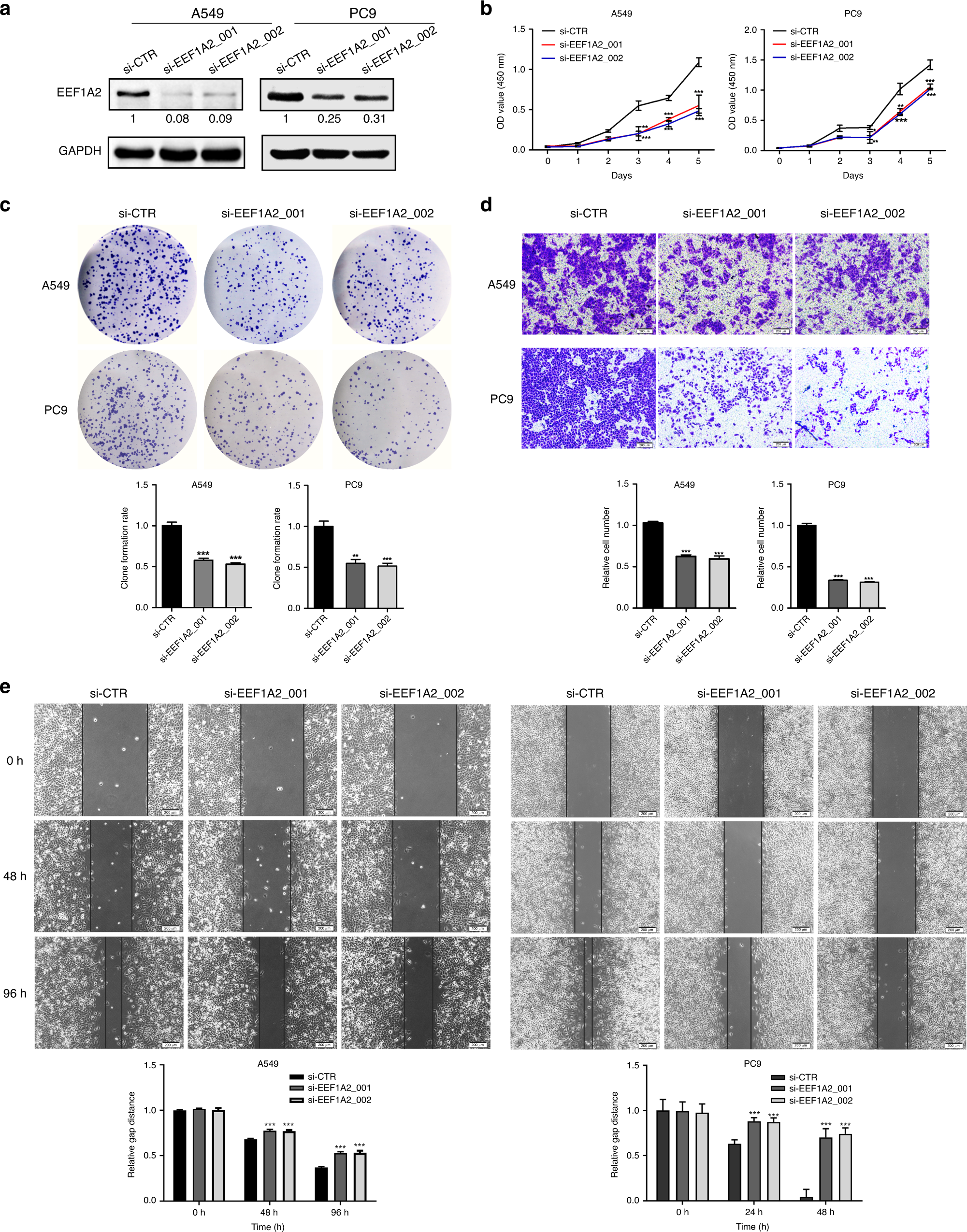 Fig. 2: Silencing of EEF1A2 decreases the proliferation, invasion, and migration abilities of A549 cells.