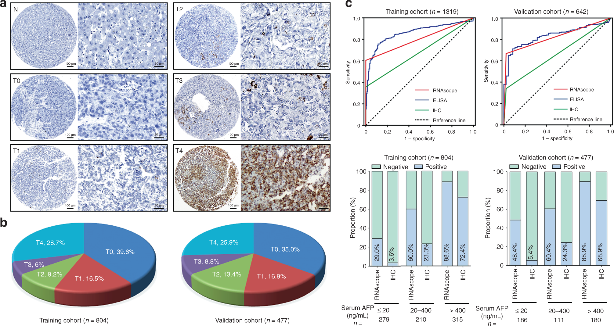 Fig. 2: Representative images for AFP RNAscope in paraffin-embedded HCC samples.