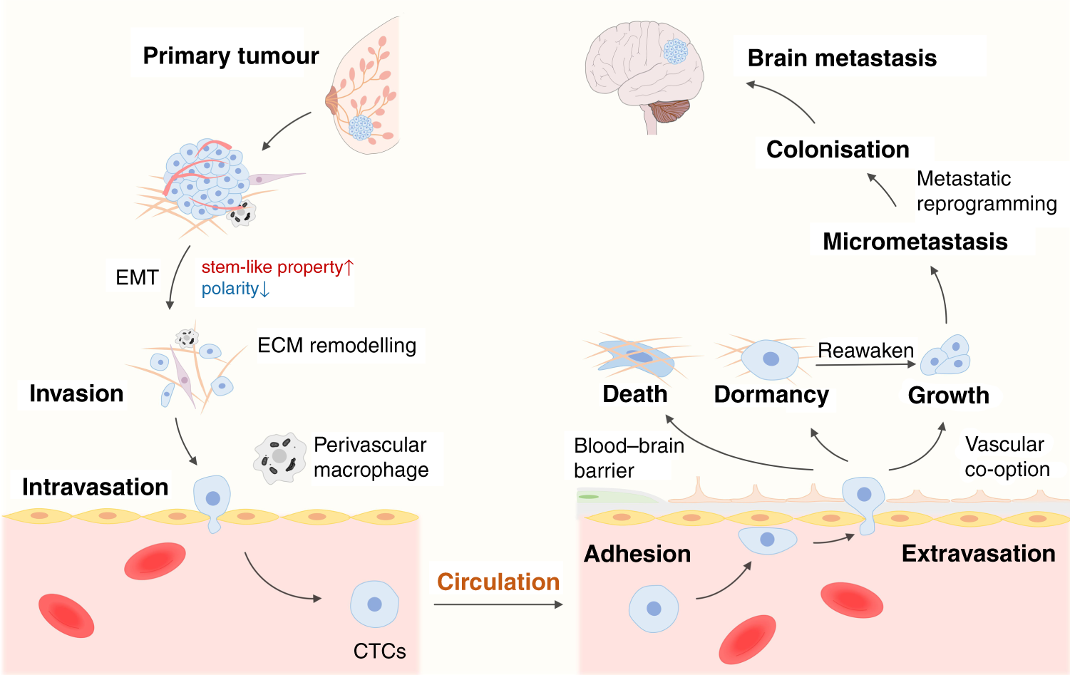 Breast cancer brain metastasis: insight into molecular mechanisms and  therapeutic strategies | British Journal of Cancer