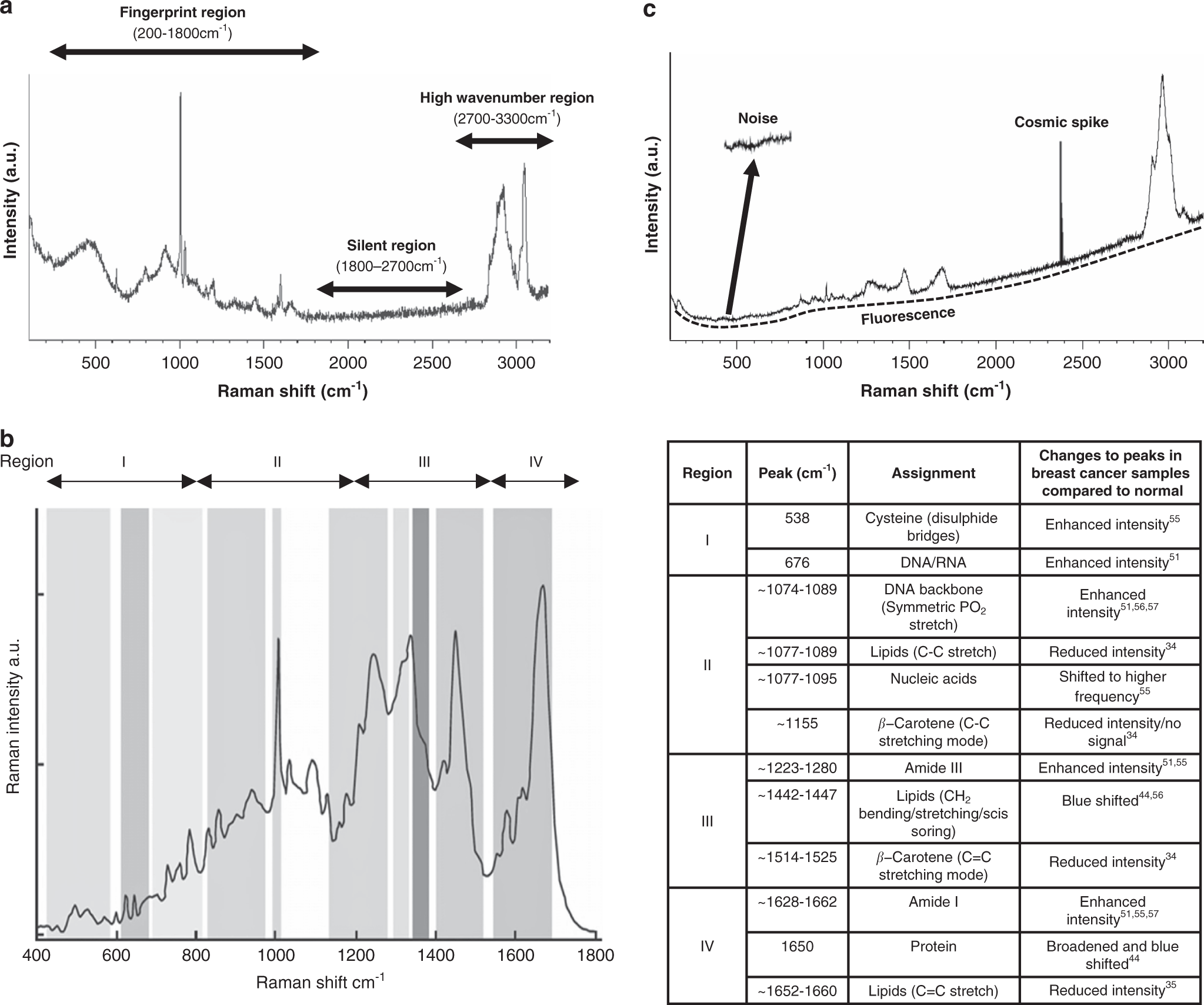 Raman spectroscopy: current applications in breast cancer diagnosis,  challenges and future prospects | British Journal of Cancer