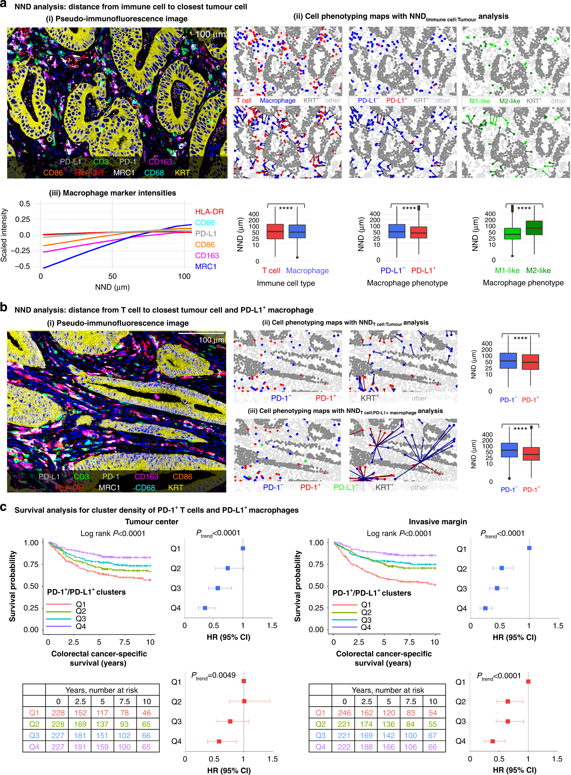 Fig. 3: Spatial analysis of immune cells using the nearest neighbour distance (NND) function and the cancer-specific survival analysis for PD-1/PD-L1 cluster density.