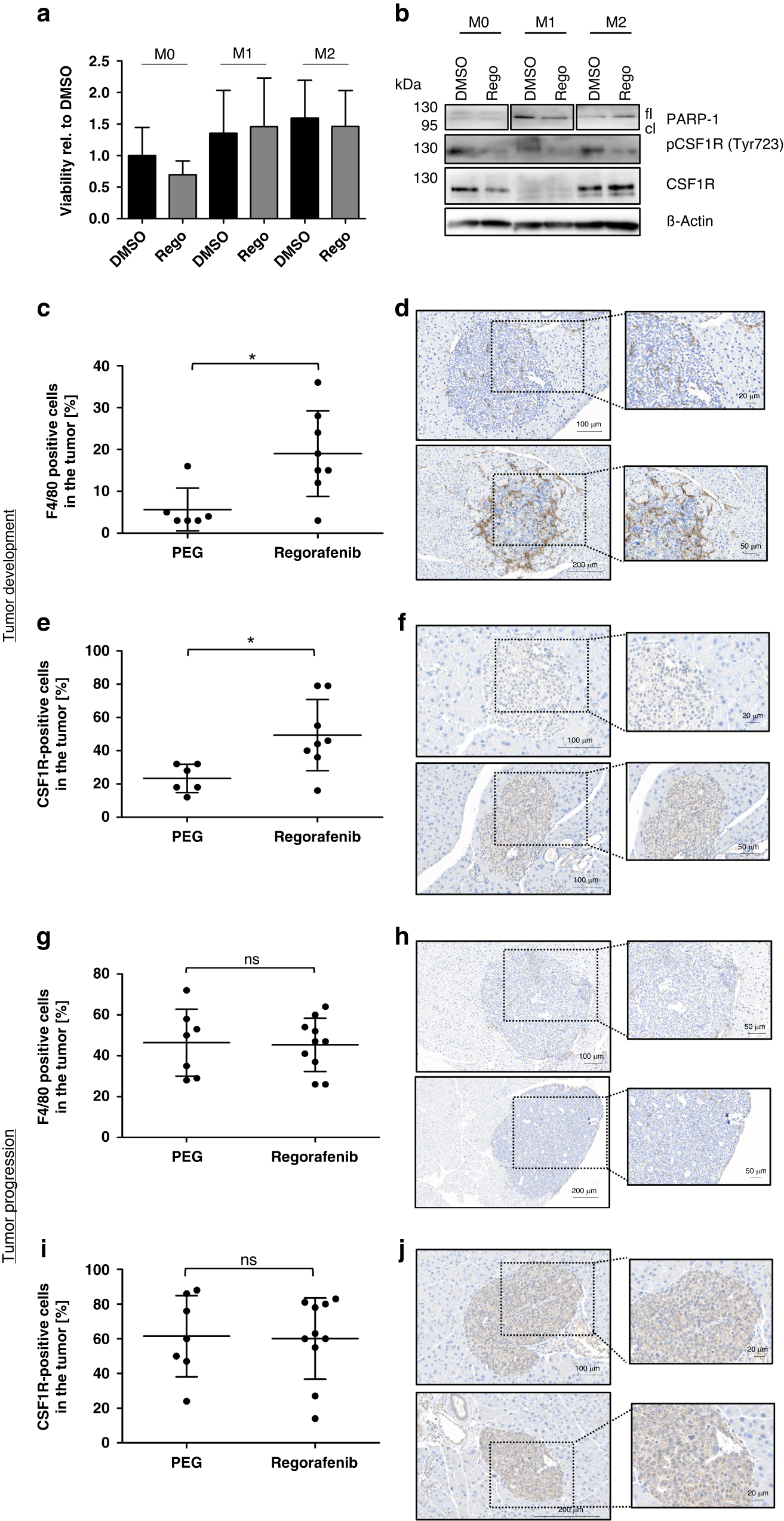 Fig. 4: Regorafenib induces a tumor-promoting micromilieu by enhancing the infiltration of M2-macrophages.