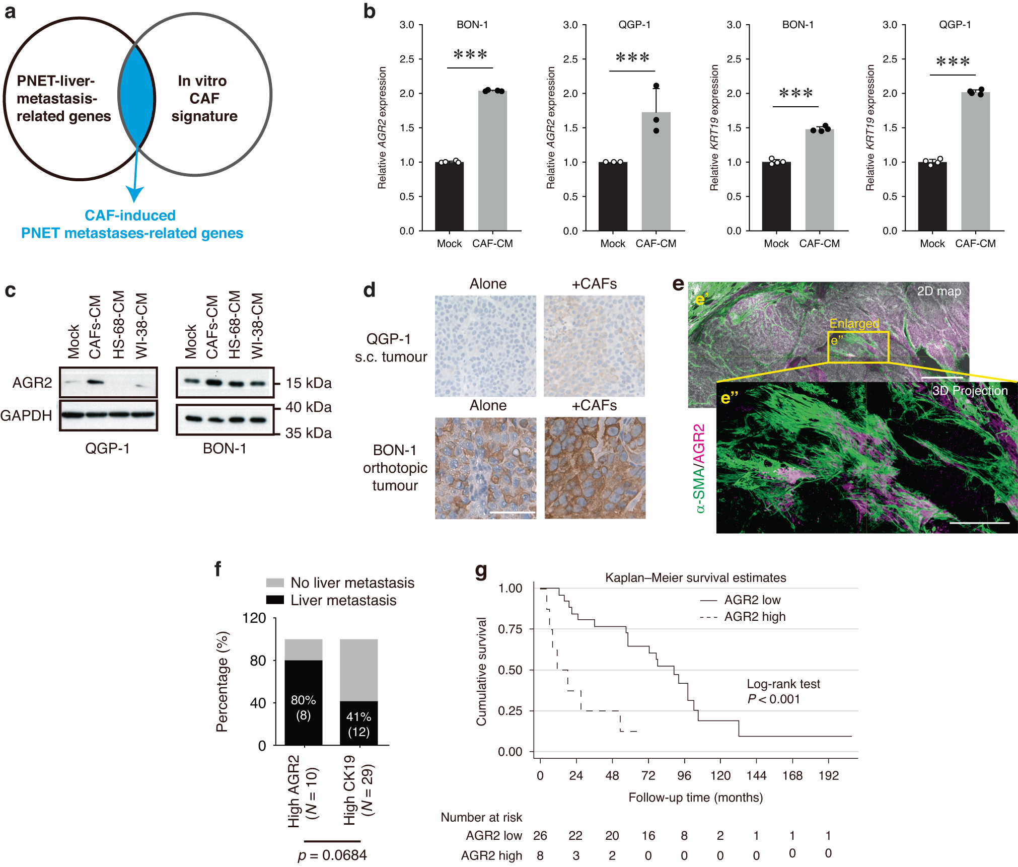 Fig. 4: Role of AGR2 in the CAF-promotion of PNET growth and liver metastasis.