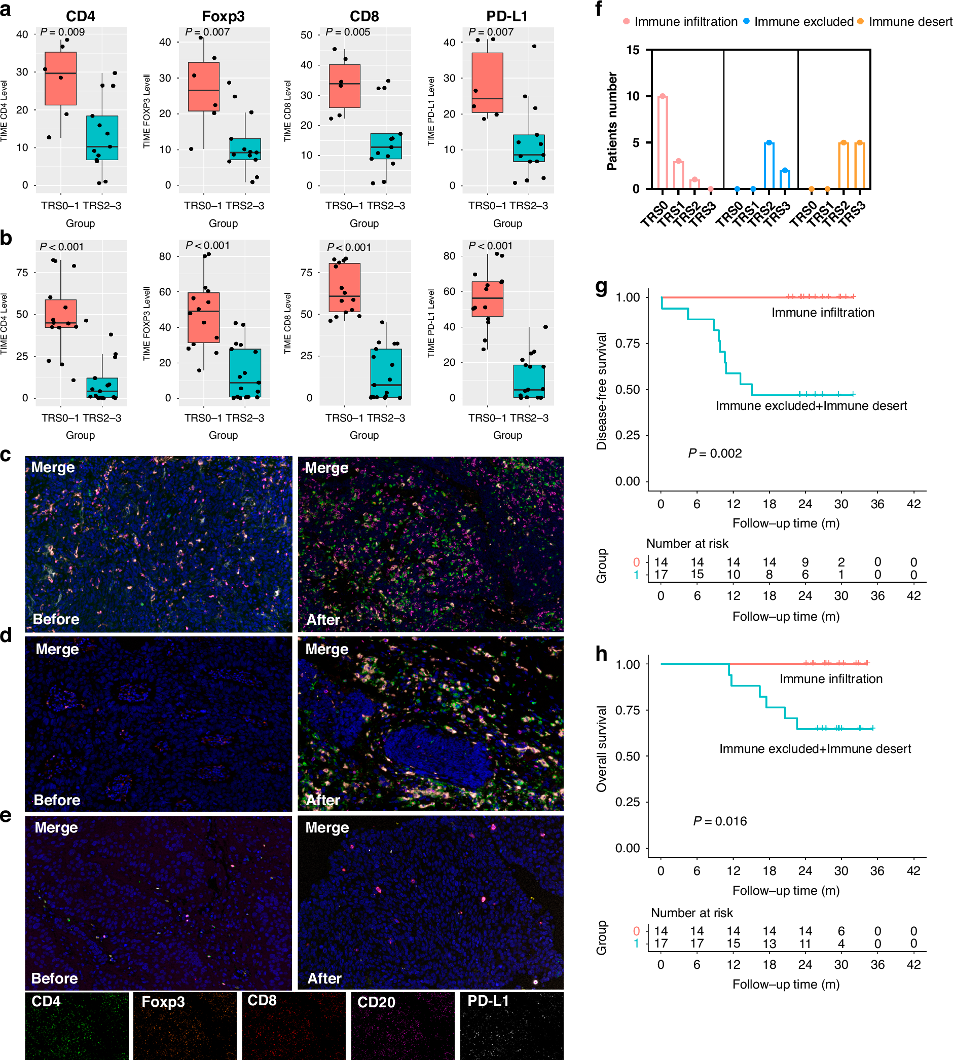 Fig. 4: T cell infiltration and TIME types in the tumour tissue by mIF.