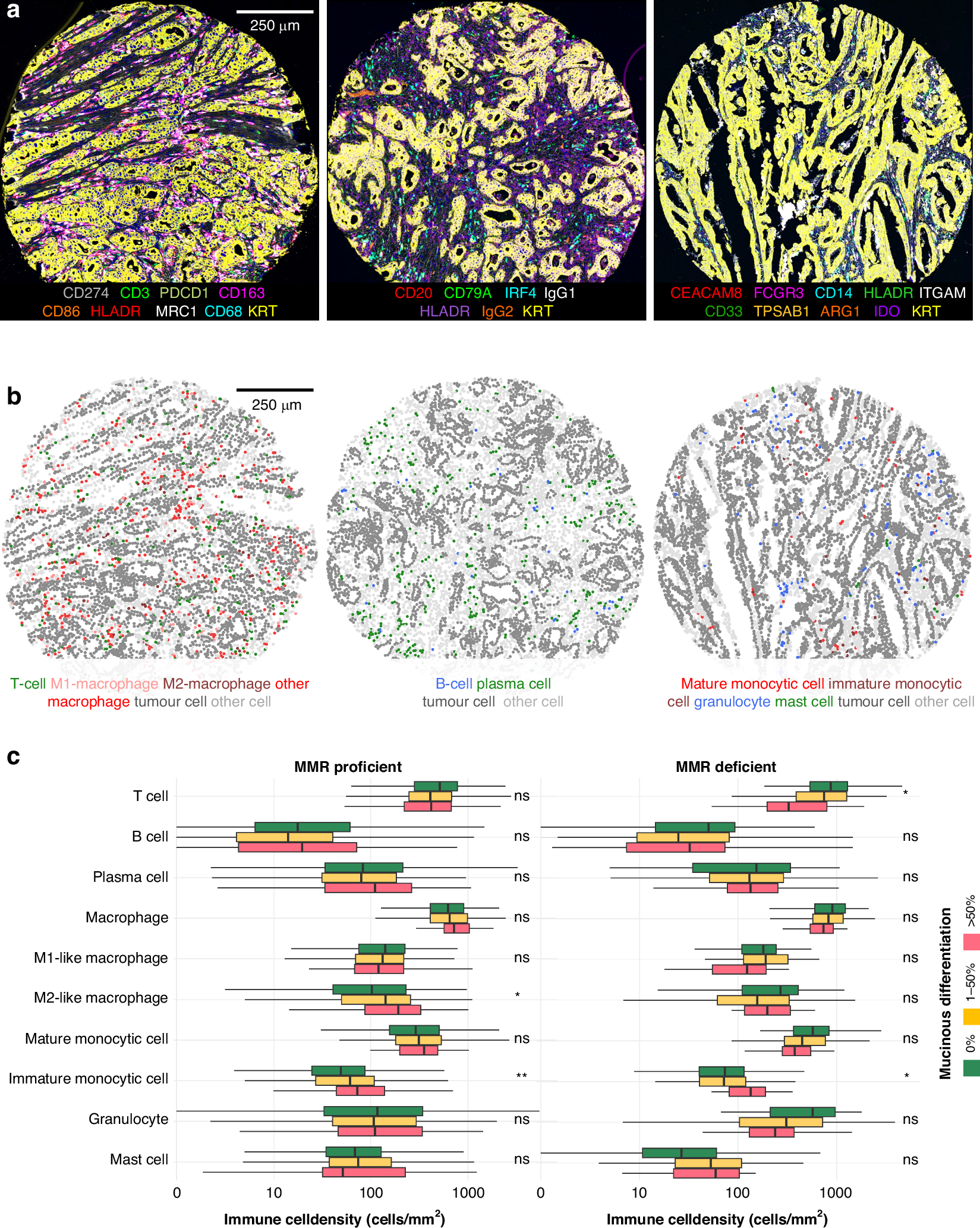 Fig. 2: Immune cell phenotyping and associations between mucinous differentiation and immune cell densities.