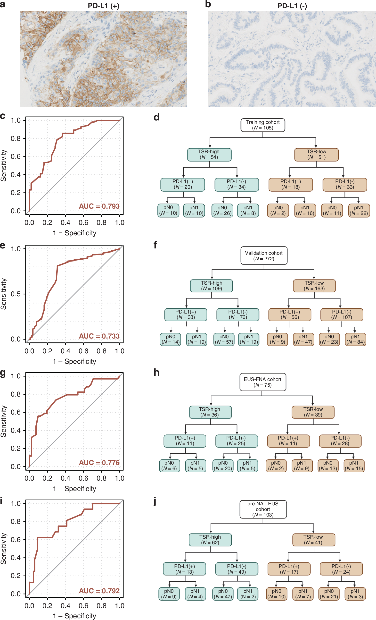 Fig. 4: Predictive performance of combination of TSR and the protein expression of PD-L1 for detecting of LNM in patients with PDAC.