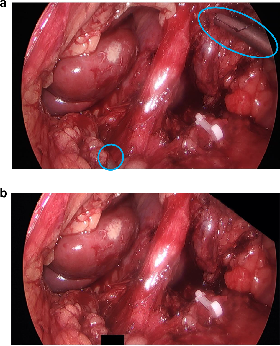 Fig. 2: Image anonymisation using ‘black boxes’.