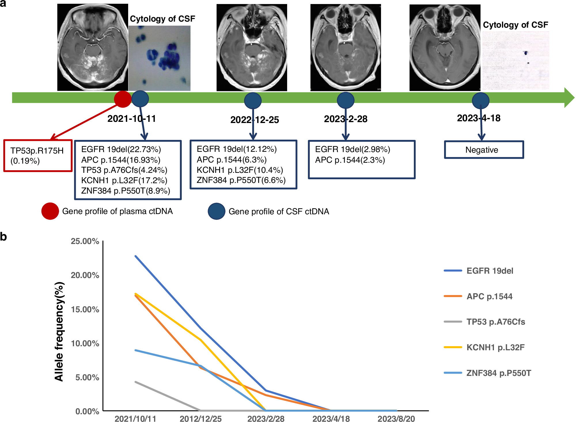 Fig. 6: MRI scans, CSF cytology and ctDNA analysis of patients with LM with failed treatment responses to third-generation EGFR-TKIs at different clinical time points.