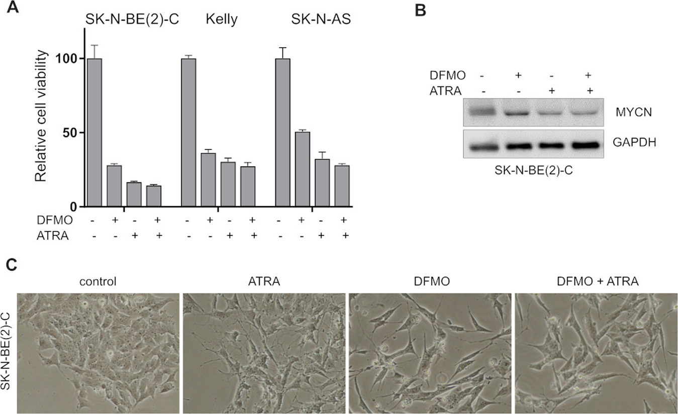 Fig. 8: DFMO affects neuroblastoma viability and MYCN expression but does not enhance differentiation-inducing potential of ATRA.