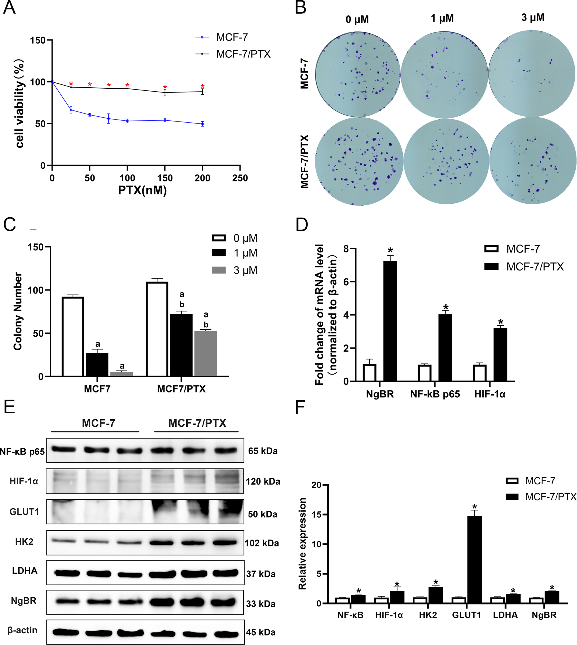 Nogo-B receptor increases glycolysis and the paclitaxel resistance of  estrogen receptor-positive breast cancer via the HIF-1α-dependent pathway |  Cancer Gene Therapy