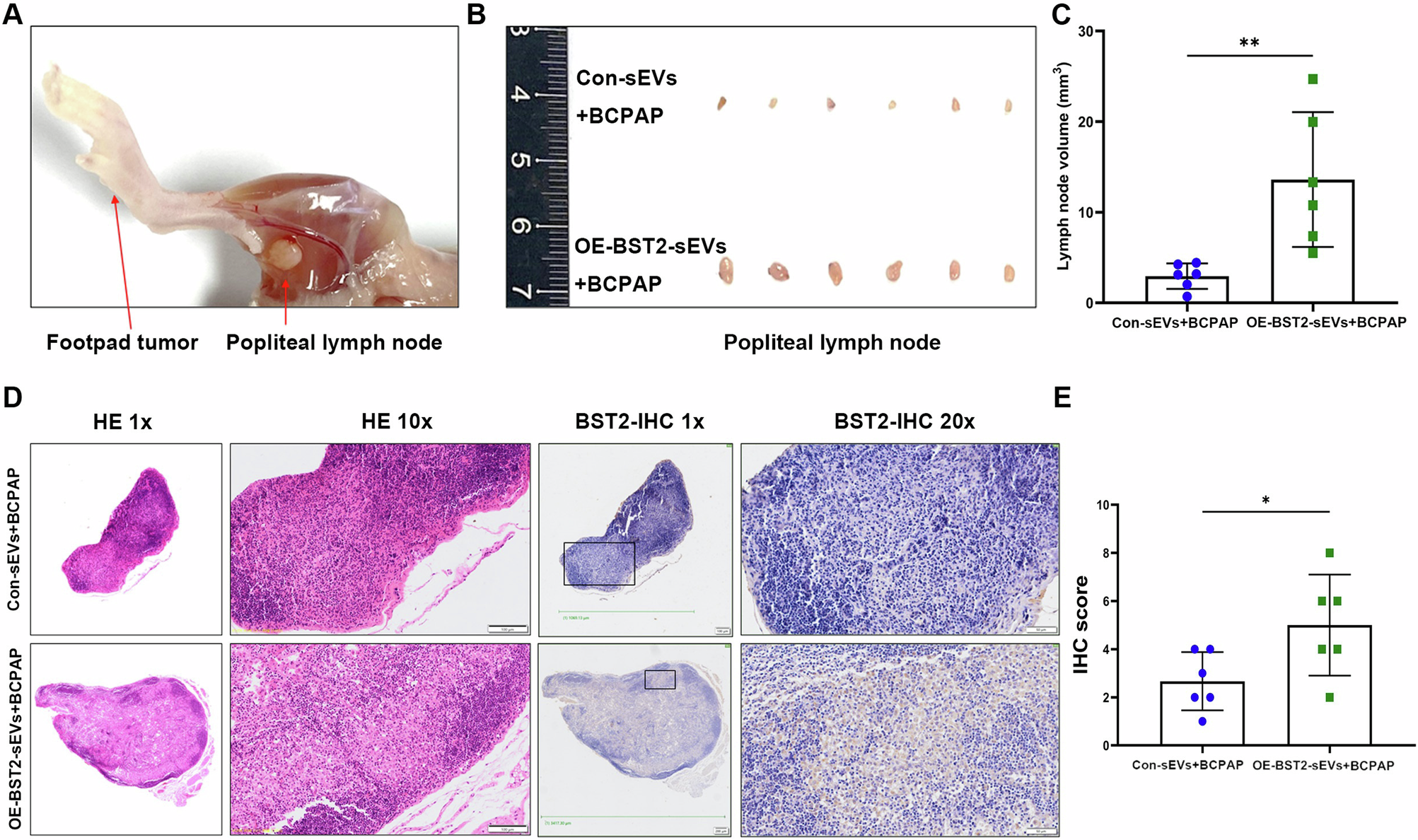 Fig. 6: SEVs BST2 promoted lymph node metastasis of PTMC in vivo.