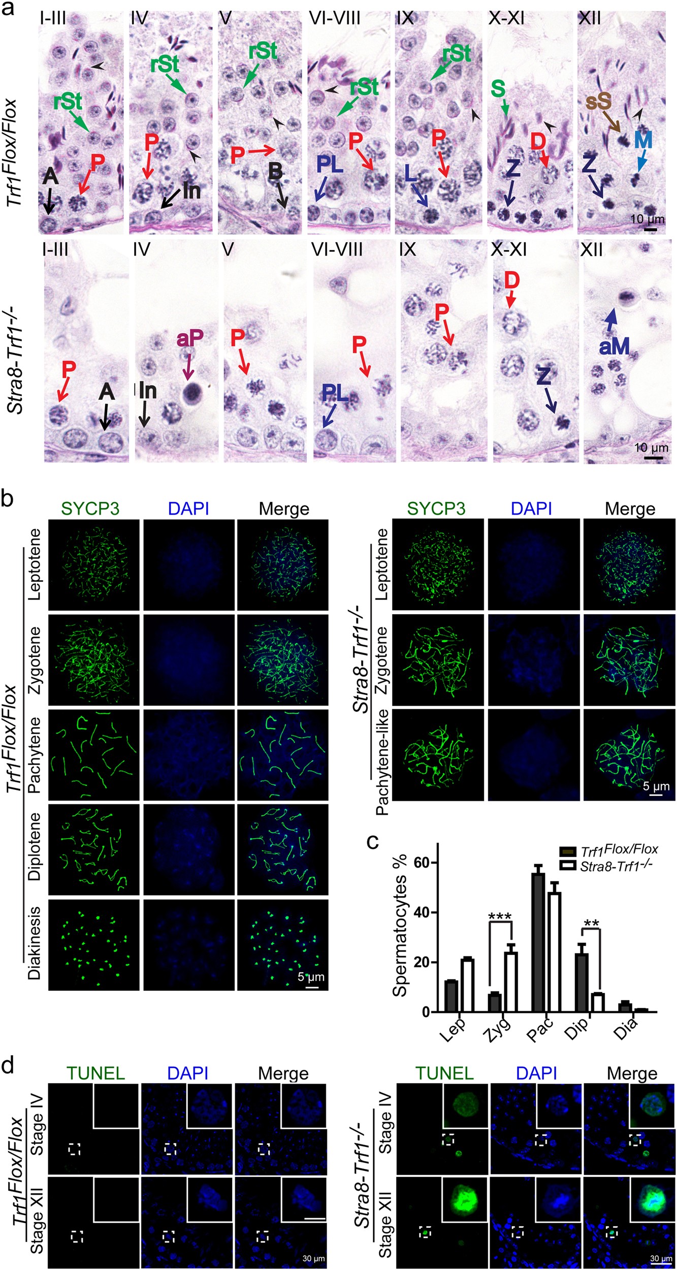 Fig. 2: Trf1-deficient spermatocytes arrest at two stages