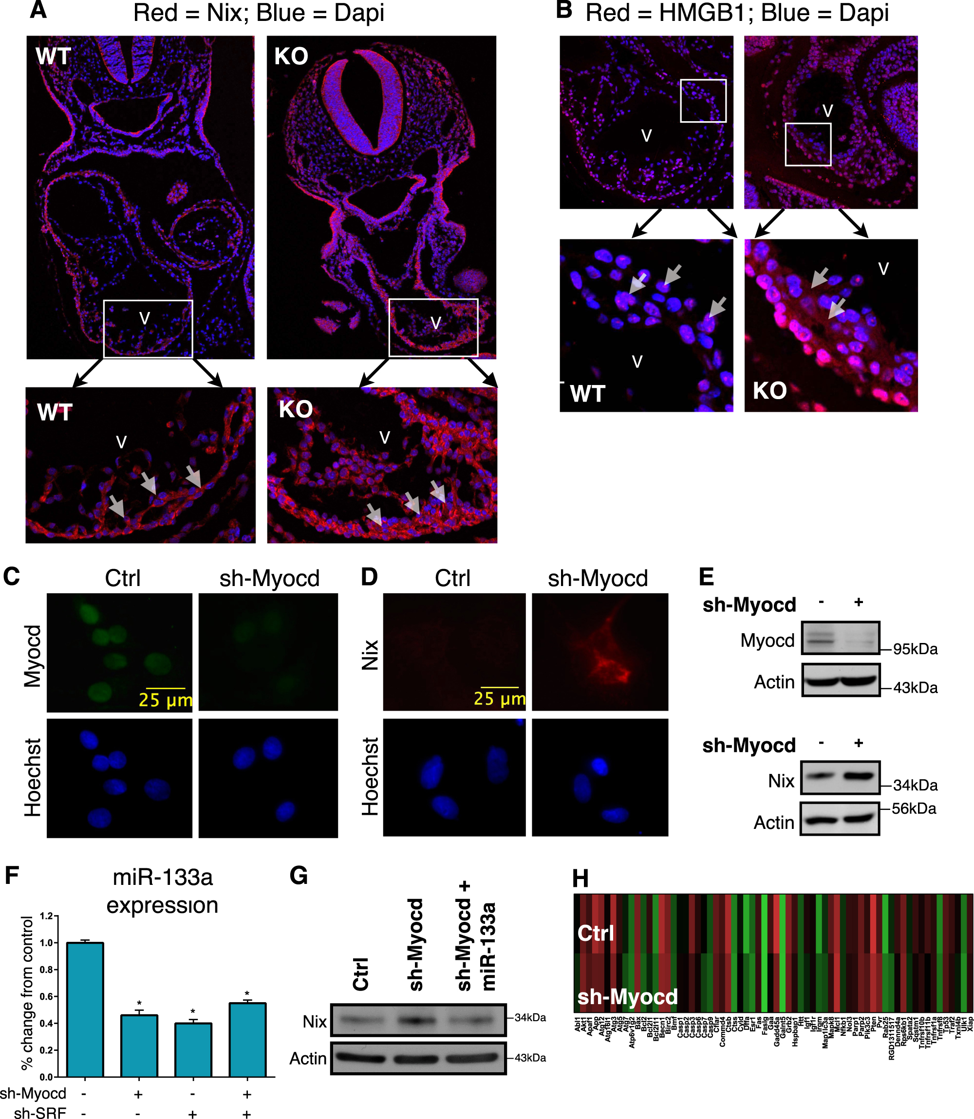 Myocardin Regulates Mitochondrial Calcium Homeostasis And