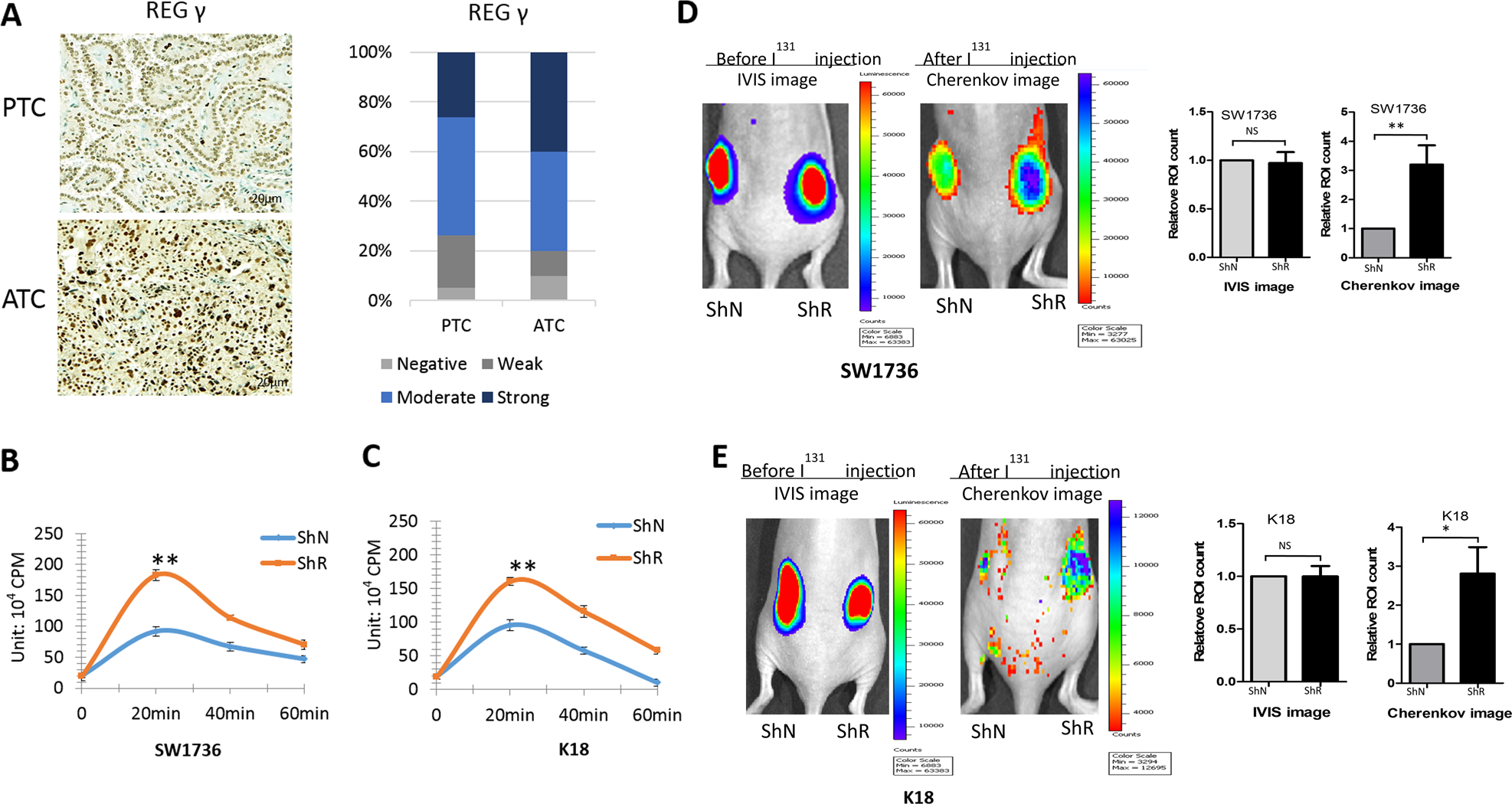 REGγ ablation impedes dedifferentiation of anaplastic thyroid carcinoma and  accentuates radio-therapeutic response by regulating the Smad7-TGF-β  pathway | Cell Death & Differentiation