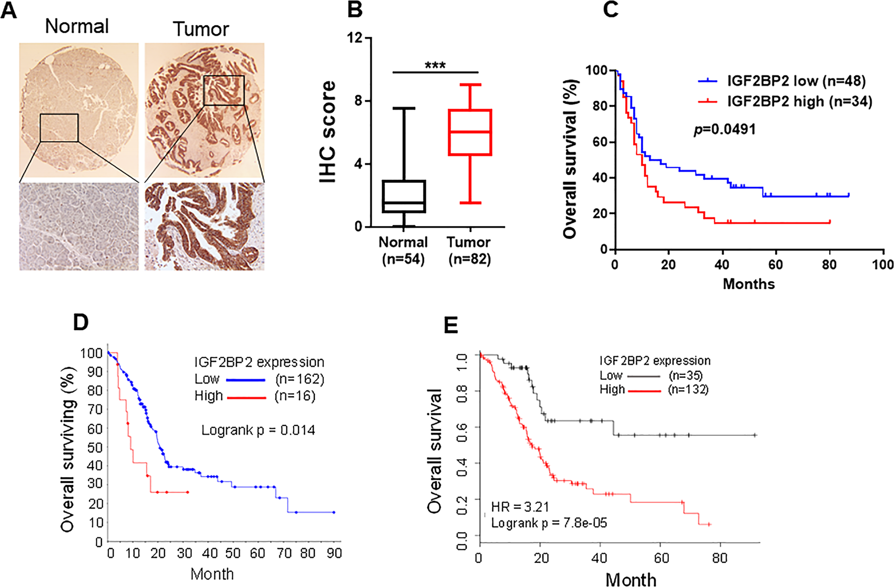 Fig. 1: IGF2BP2 is highly expressed in pancreatic cancer, and is associated with clinical outcomes.