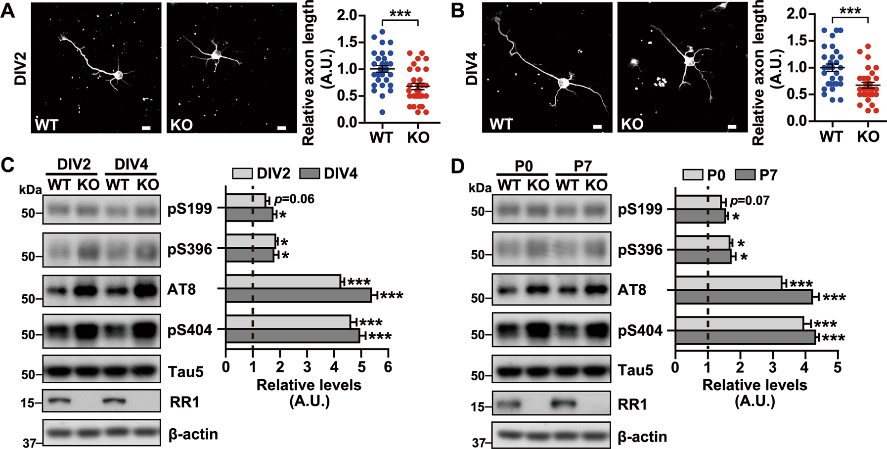 RPS23RG1 modulates tau phosphorylation and axon outgrowth through  regulating p35 proteasomal degradation | Cell Death & Differentiation