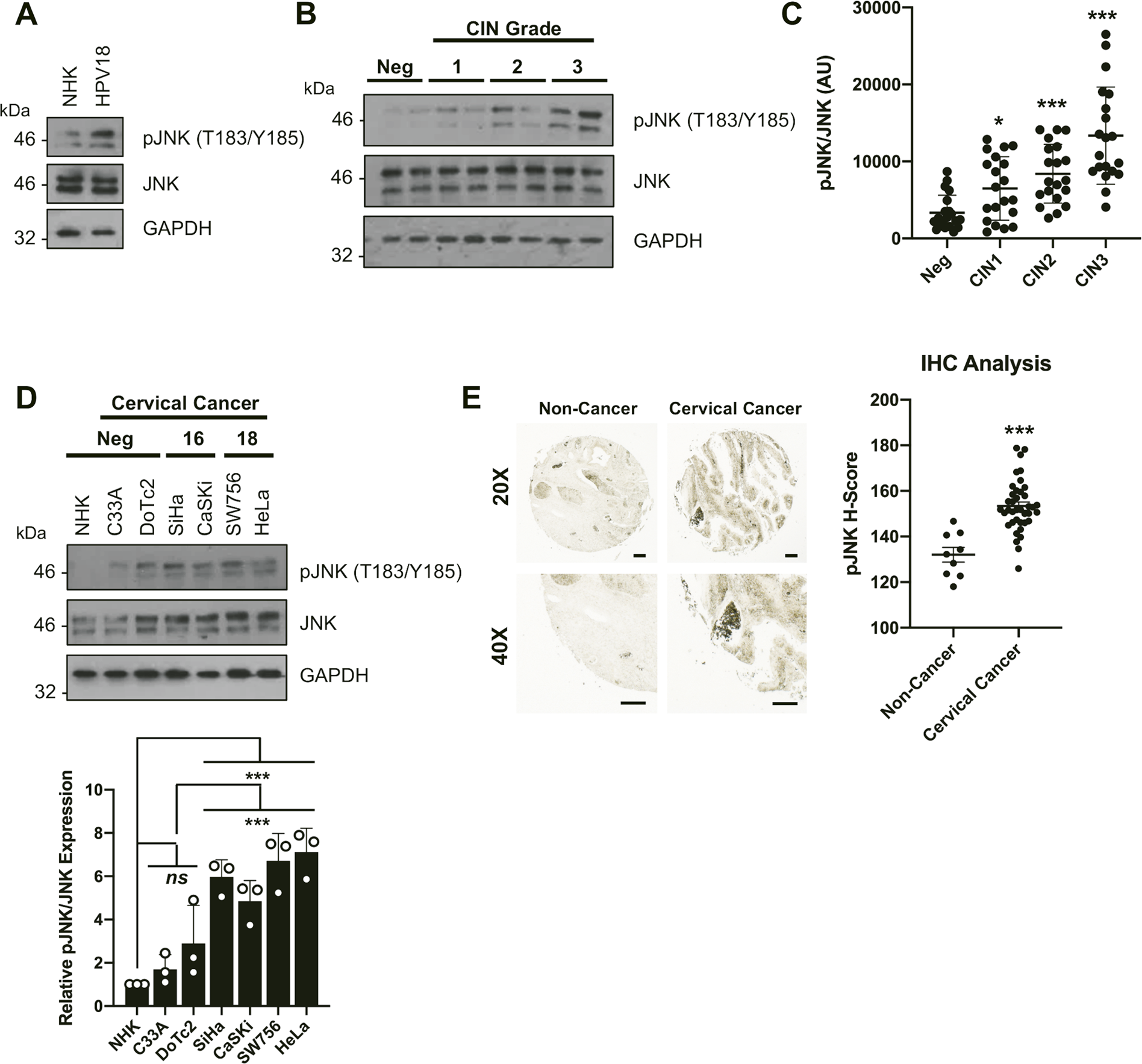 E6 Mediated Activation Of Jnk Drives Egfr Signalling To Promote Proliferation And Viral Oncoprotein Expression In Cervical Cancer Cell Death Differentiation E6 Mediated Activation Of Jnk Drives Egfr Signalling To Promote Proliferation And Viral Oncoprotein Expression In Cervical Cancer Cell Death Differentiation
