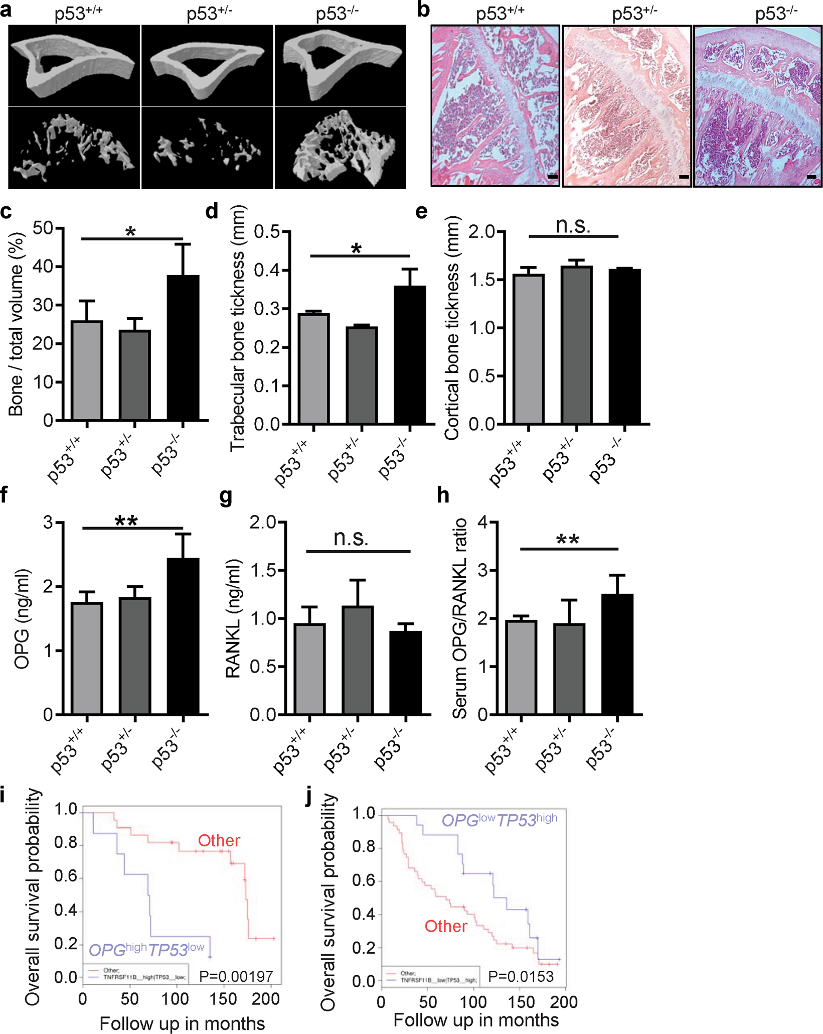 Fig. 1: Loss of p53 impairs bone homeostasis and the normal OPG/RANKL ratio.