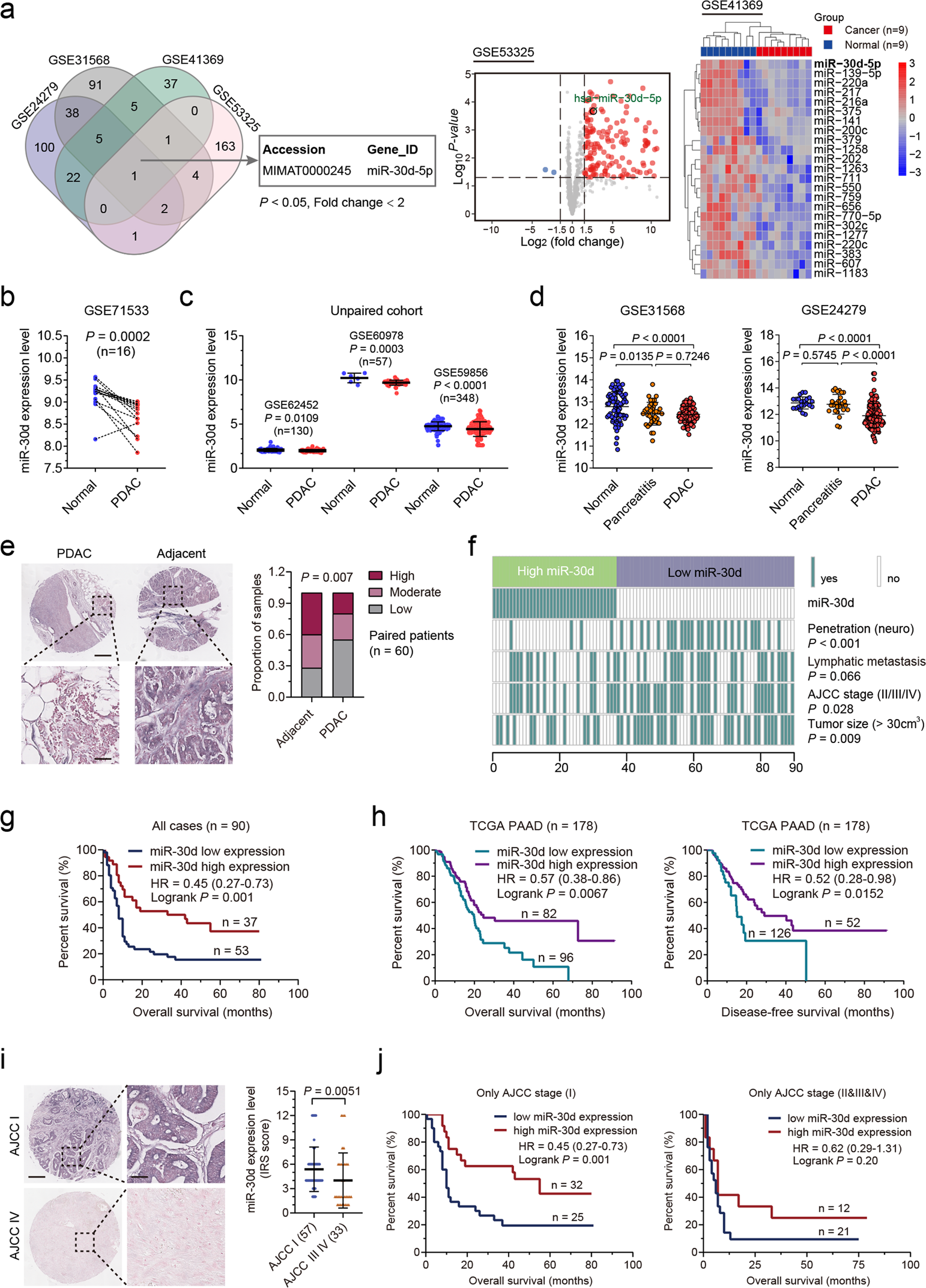 YTHDC1-mediated augmentation of miR-30d in repressing pancreatic  tumorigenesis via attenuation of RUNX1-induced transcriptional activation  of Warburg effect | Cell Death & Differentiation