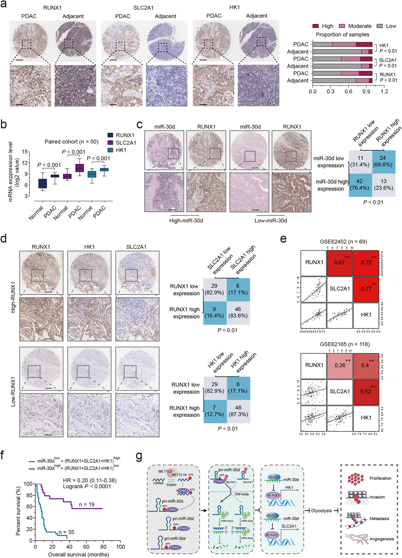 Fig. 7: Clinical significance of miR-30d/RUNX1/SLC2A1/HK1 axis in PDAC patients.