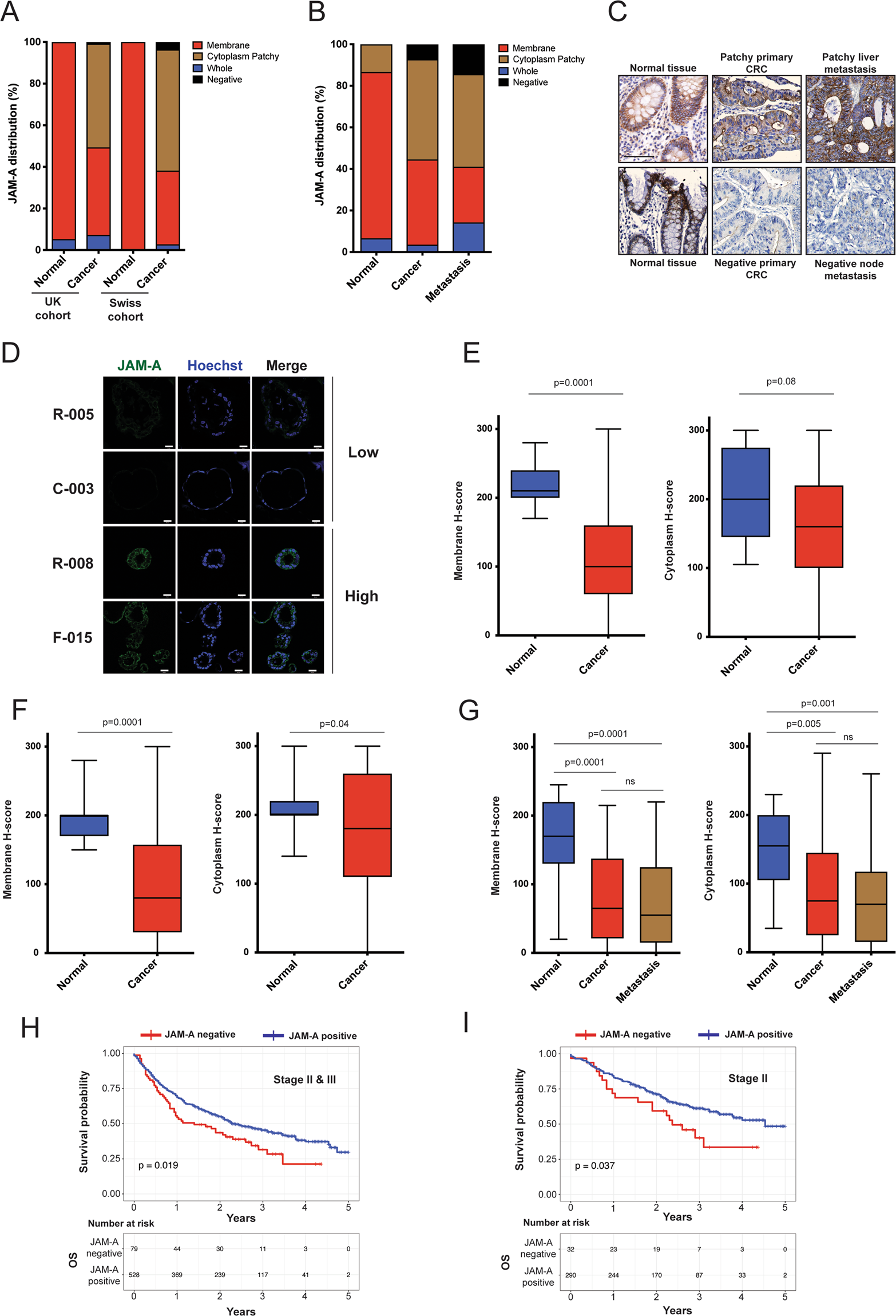 MIR21-induced loss of junctional adhesion molecule A promotes activation of  oncogenic pathways, progression and metastasis in colorectal cancer | Cell  Death & Differentiation
