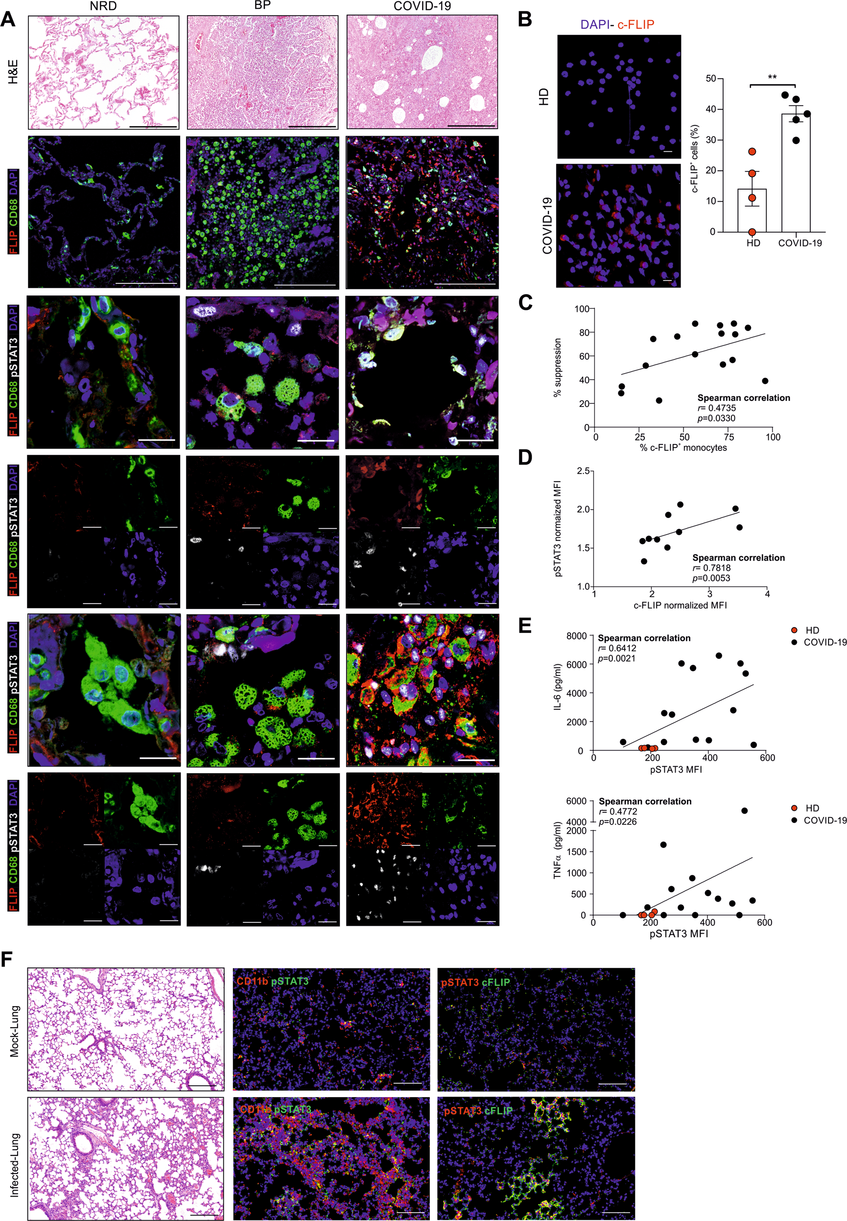 Fatal cytokine release syndrome by an aberrant FLIP/STAT3 axis | Cell Death  & Differentiation