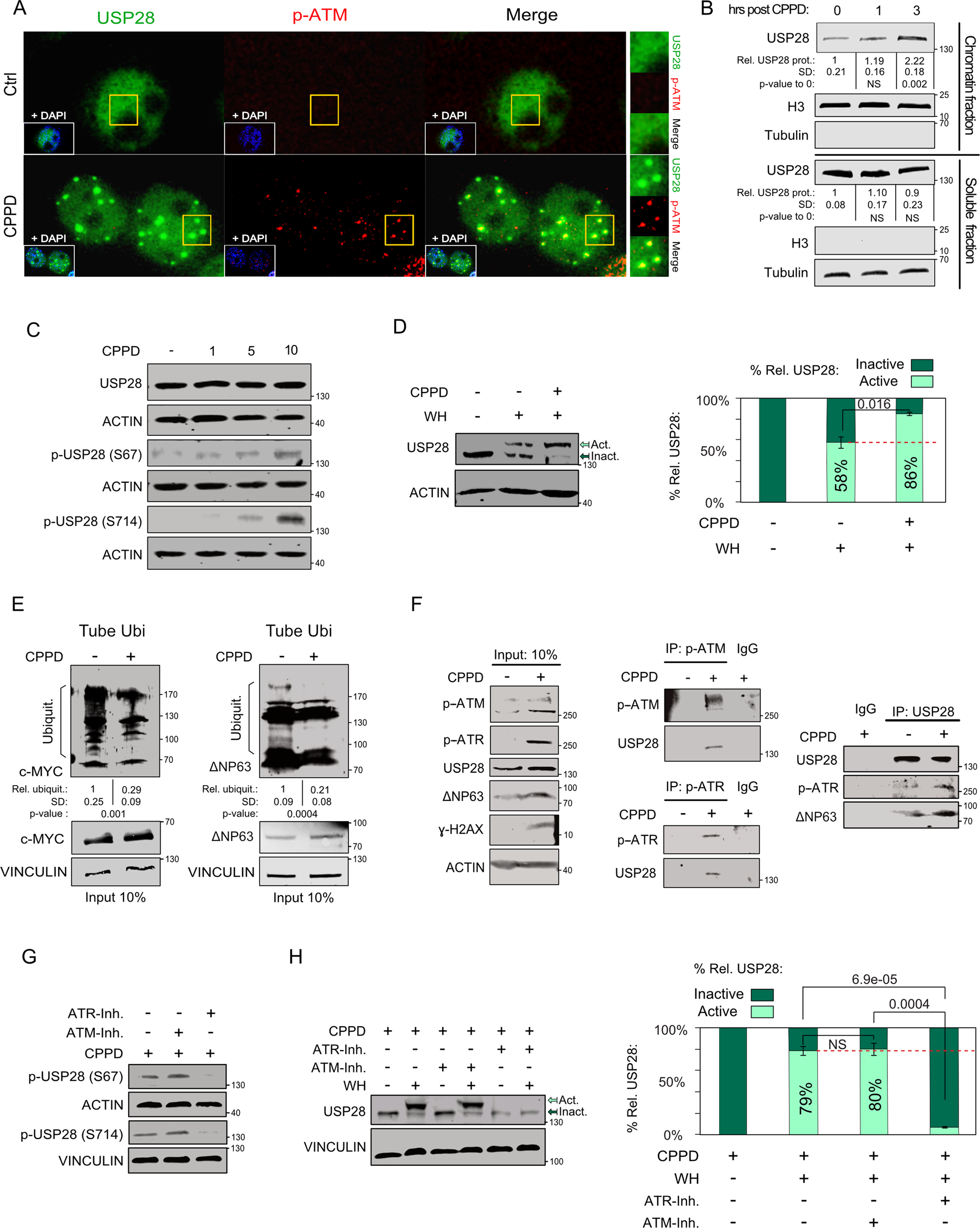Inhibition of USP28 overcomes Cisplatin-resistance of squamous tumors by  suppression of the Fanconi anemia pathway | Cell Death & Differentiation
