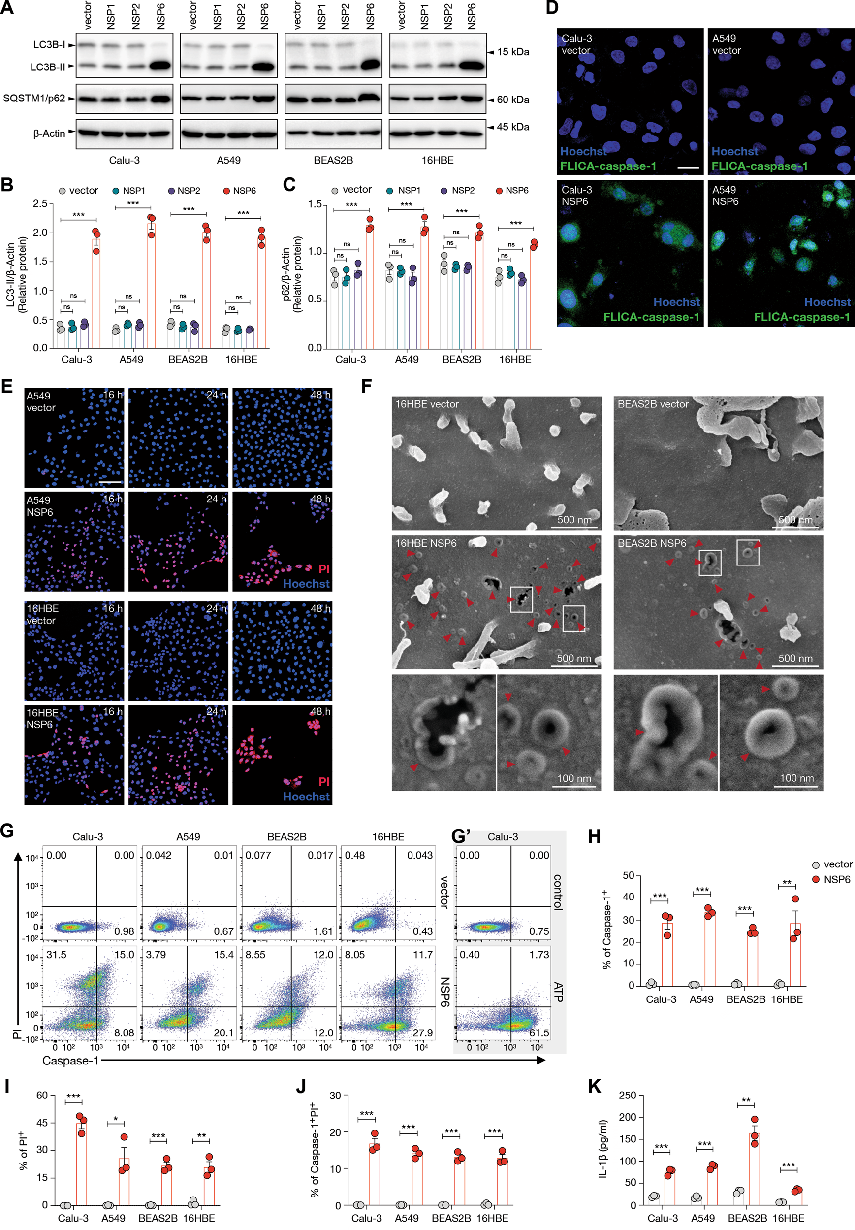 Fig. 3: NSP6 impaired the autophagic flux and induced the activation of inflammasomes in lung epithelial cells.