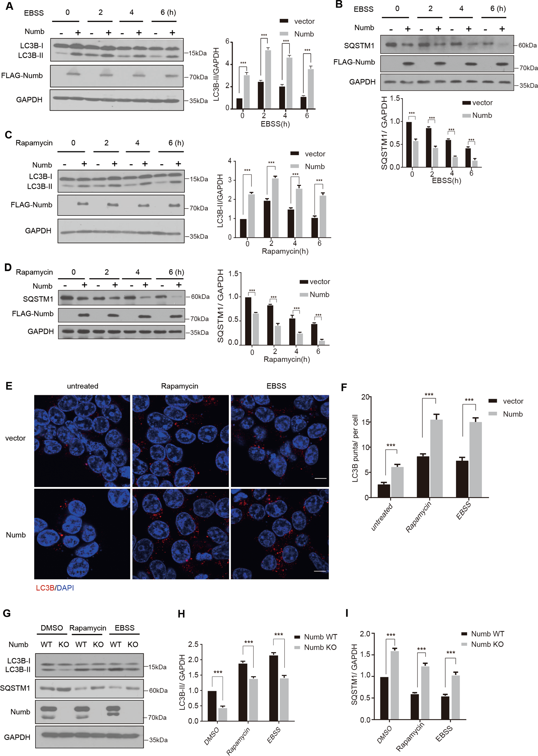 NUMB facilitates autophagy initiation through targeting SCFβ-TrCP2 complex  | Cell Death & Differentiation