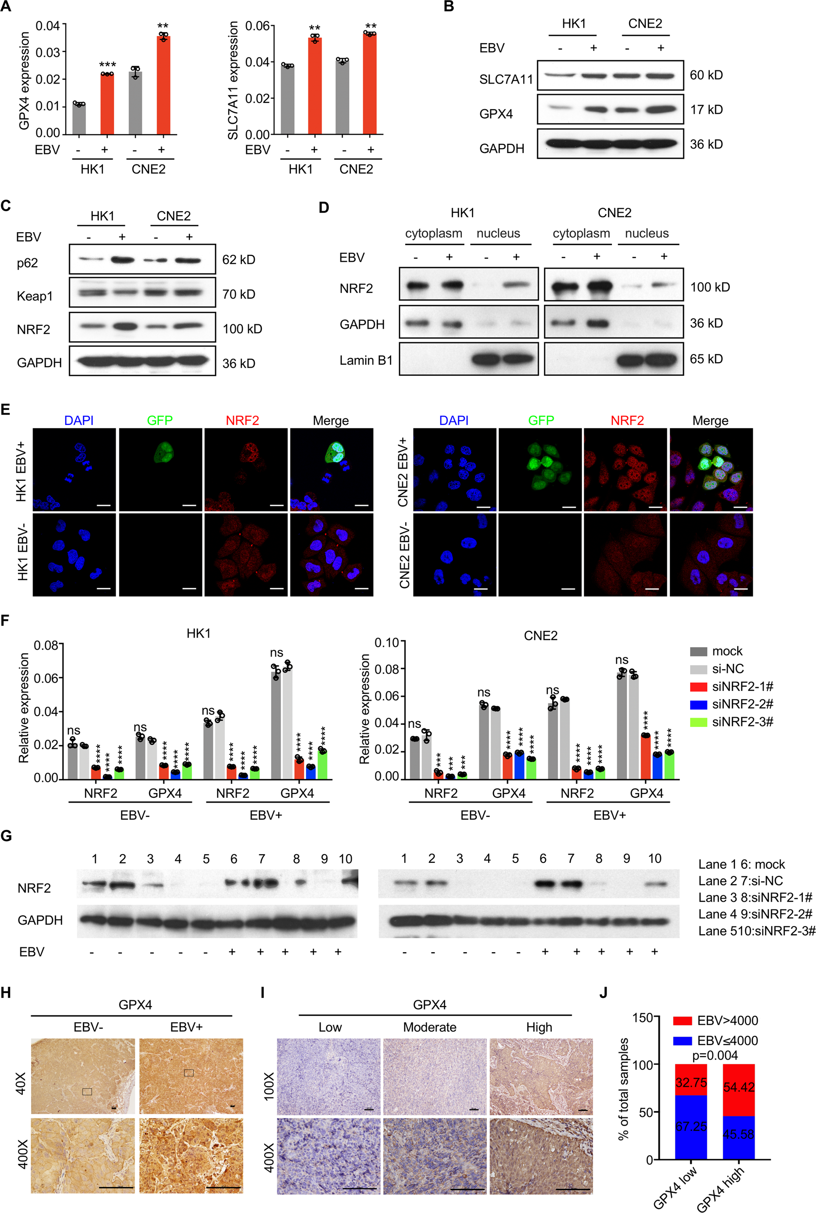 Fig. 2: EBV infection activates the p62-Keap1-NRF2 signaling pathway and induces high GPX4 expression in NPC cells.
