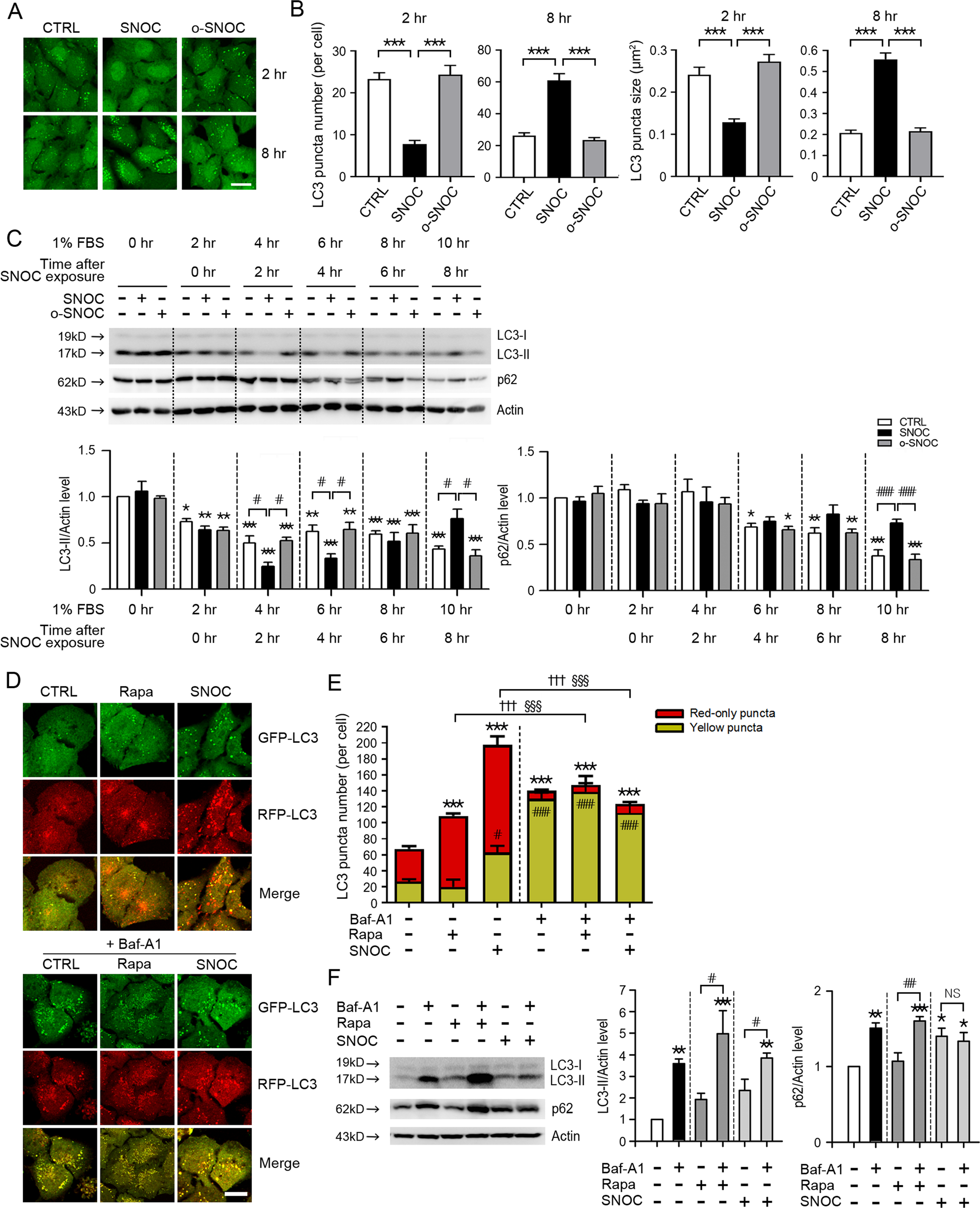 S-Nitrosylation of cathepsin B affects autophagic flux and accumulation of  protein aggregates in neurodegenerative disorders | Cell Death &  Differentiation
