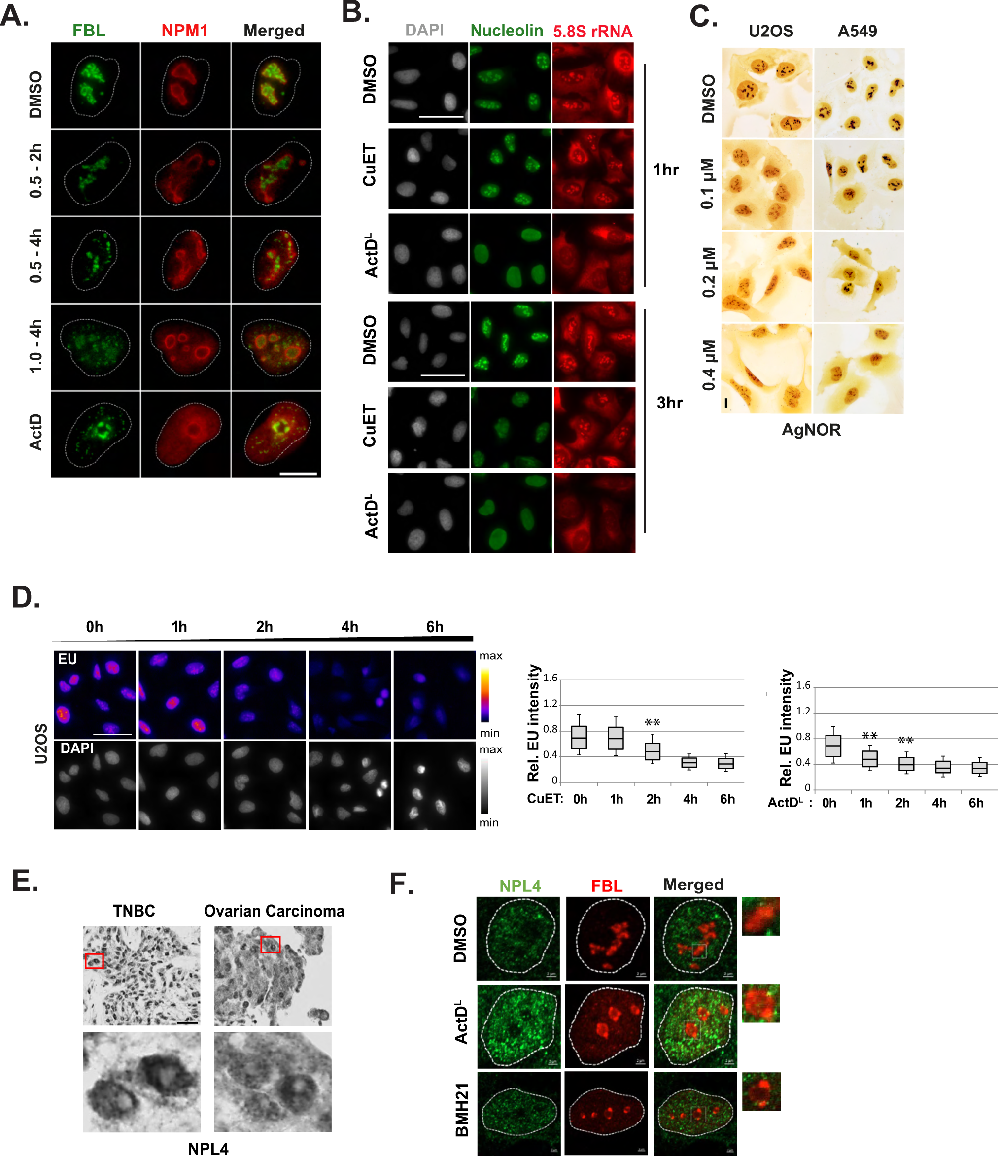 Fig. 2: CuET alters the nucleolar morphology.
