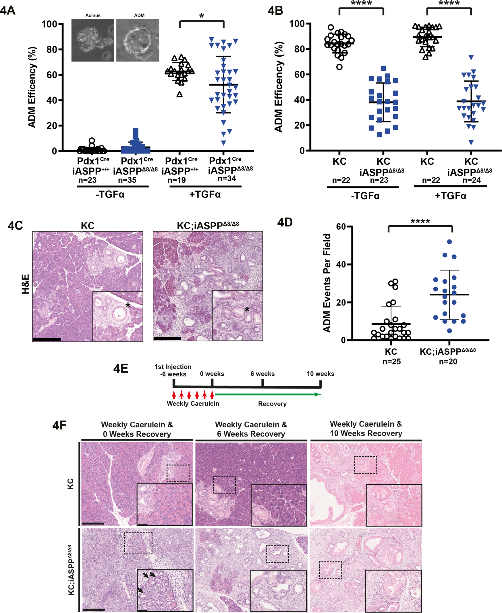 Fig. 4: iASPP is a paradoxical suppressor of oncogenic KRAS- and inflammation-induced ADM in vivo.