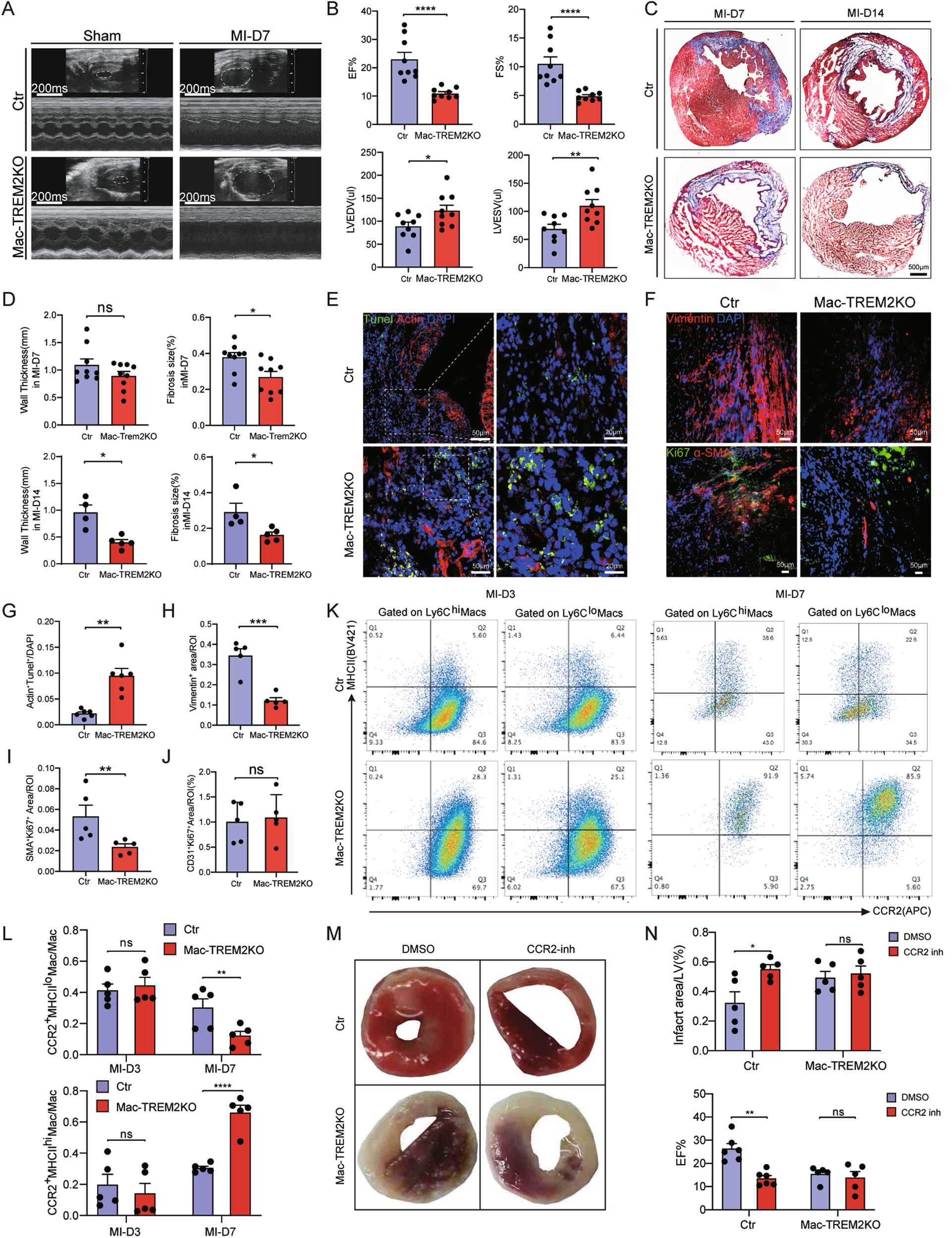 Fig. 2: Effect of the TREM2’s conditional knockout in macrophages on the heart of MI mouse.