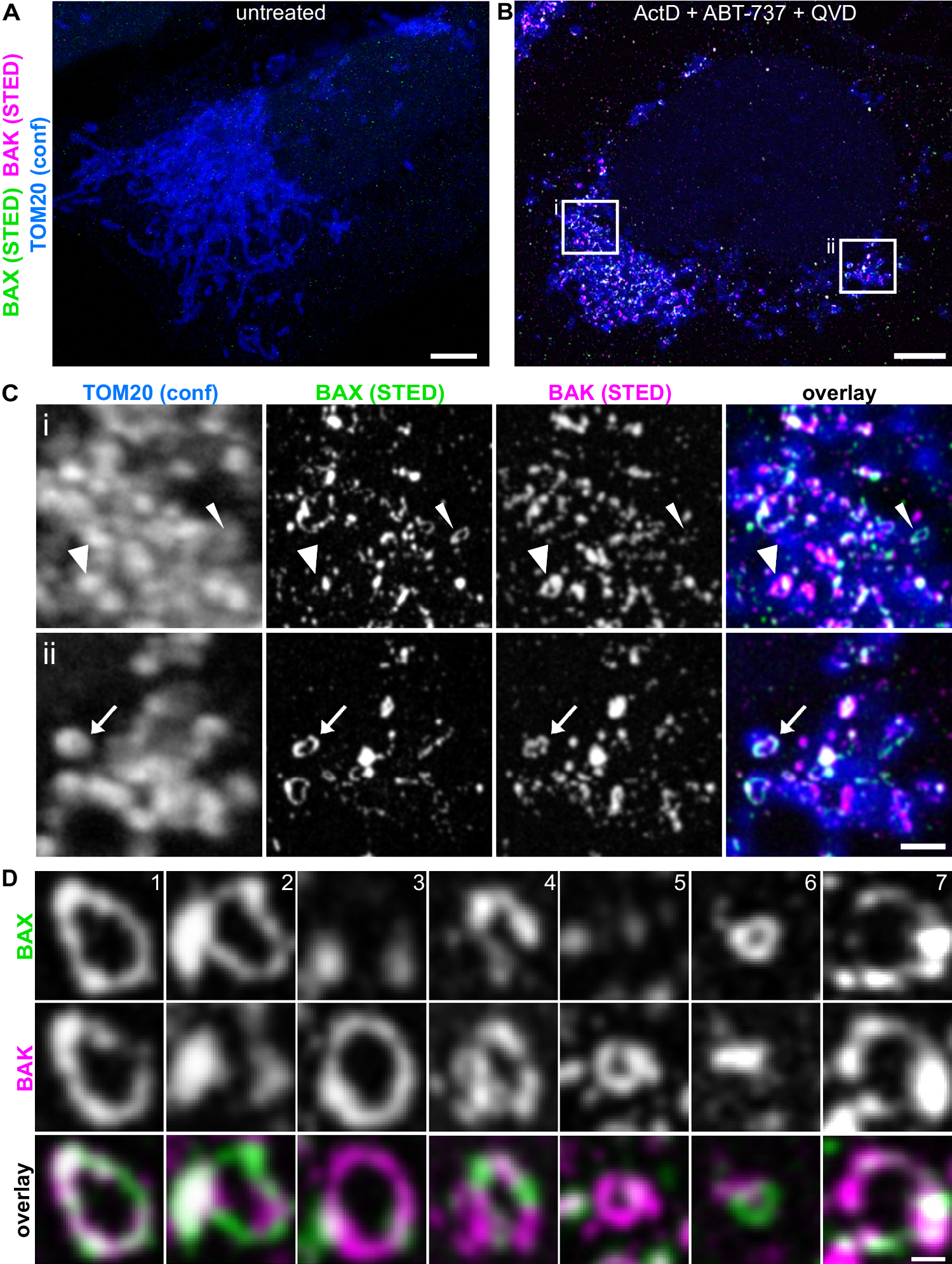 Fig. 2: Endogenous BAX and BAK together form mosaic rings in cellulo.