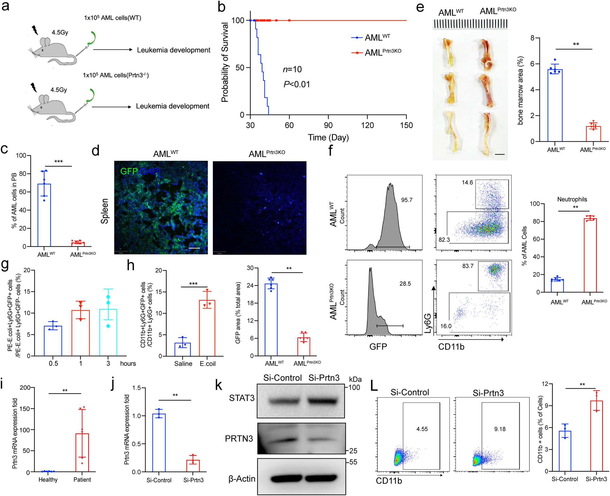 Fig. 7: PTRN3 deficiency restarts the maturation and differentiation of leukemic blast.